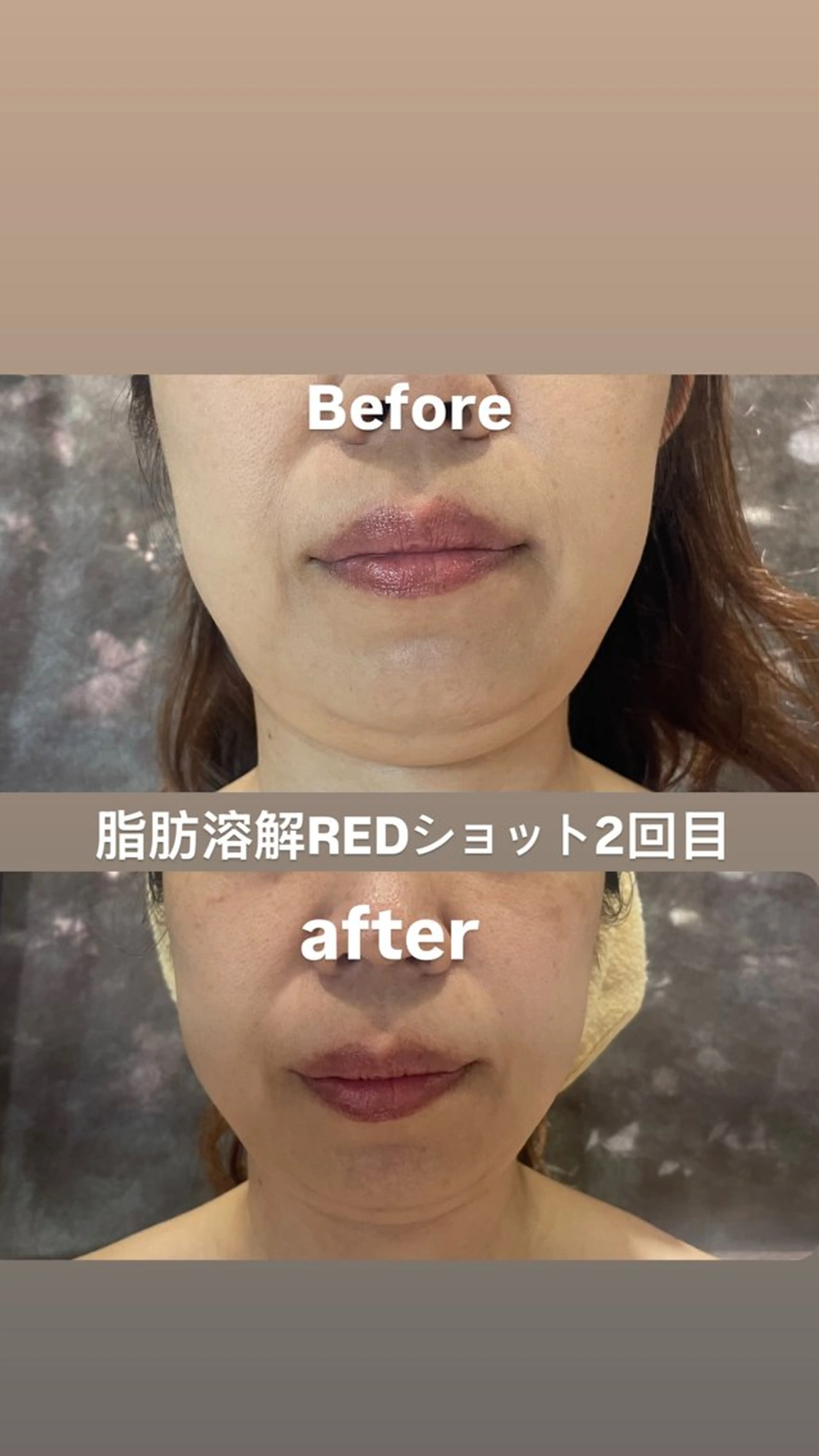 エステ Beautysalonプルメリア所属・エステ プルメリアのエステ・リラクイメージ