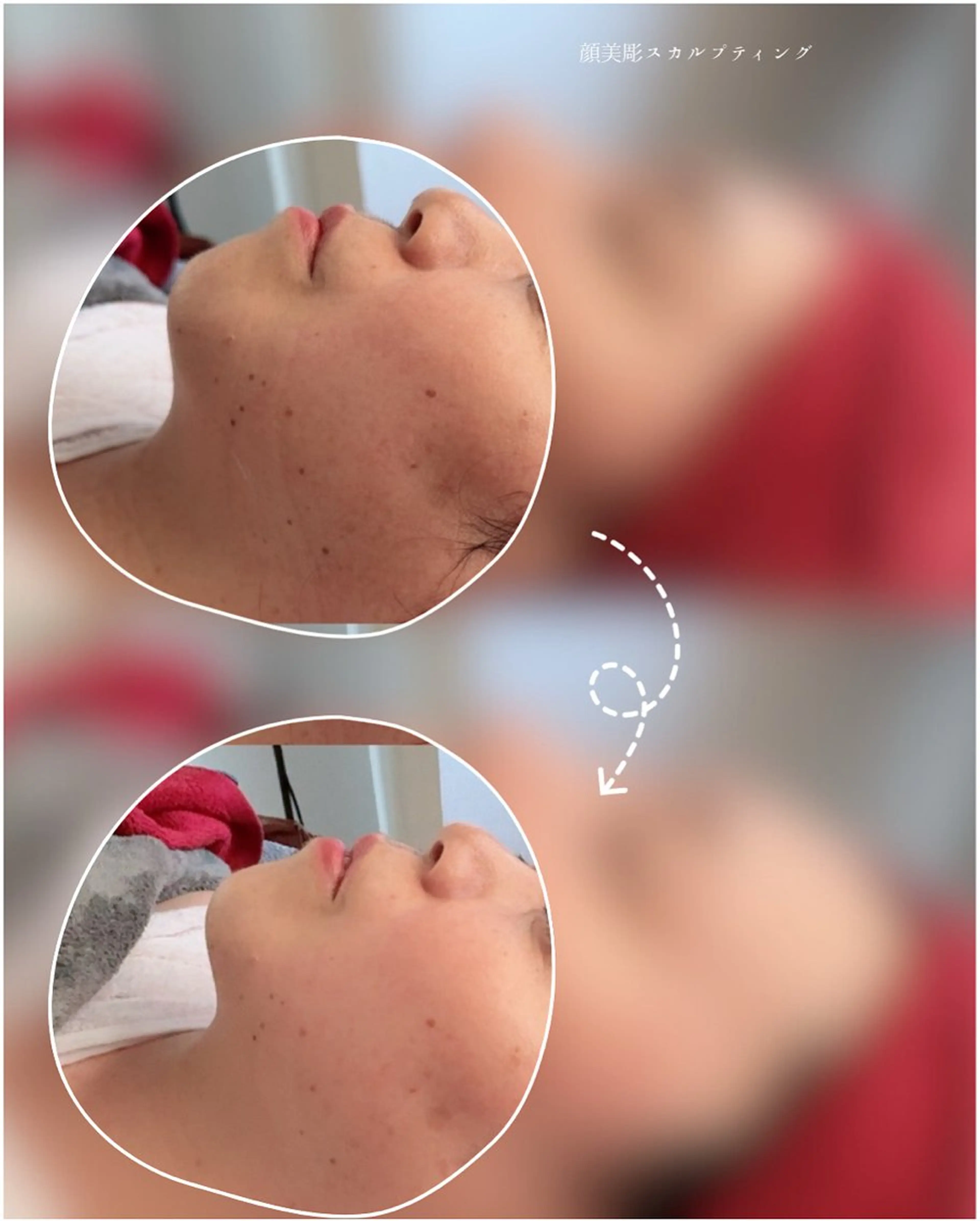 【顔美彫　スカルプティング】　輪郭を美しくの写真