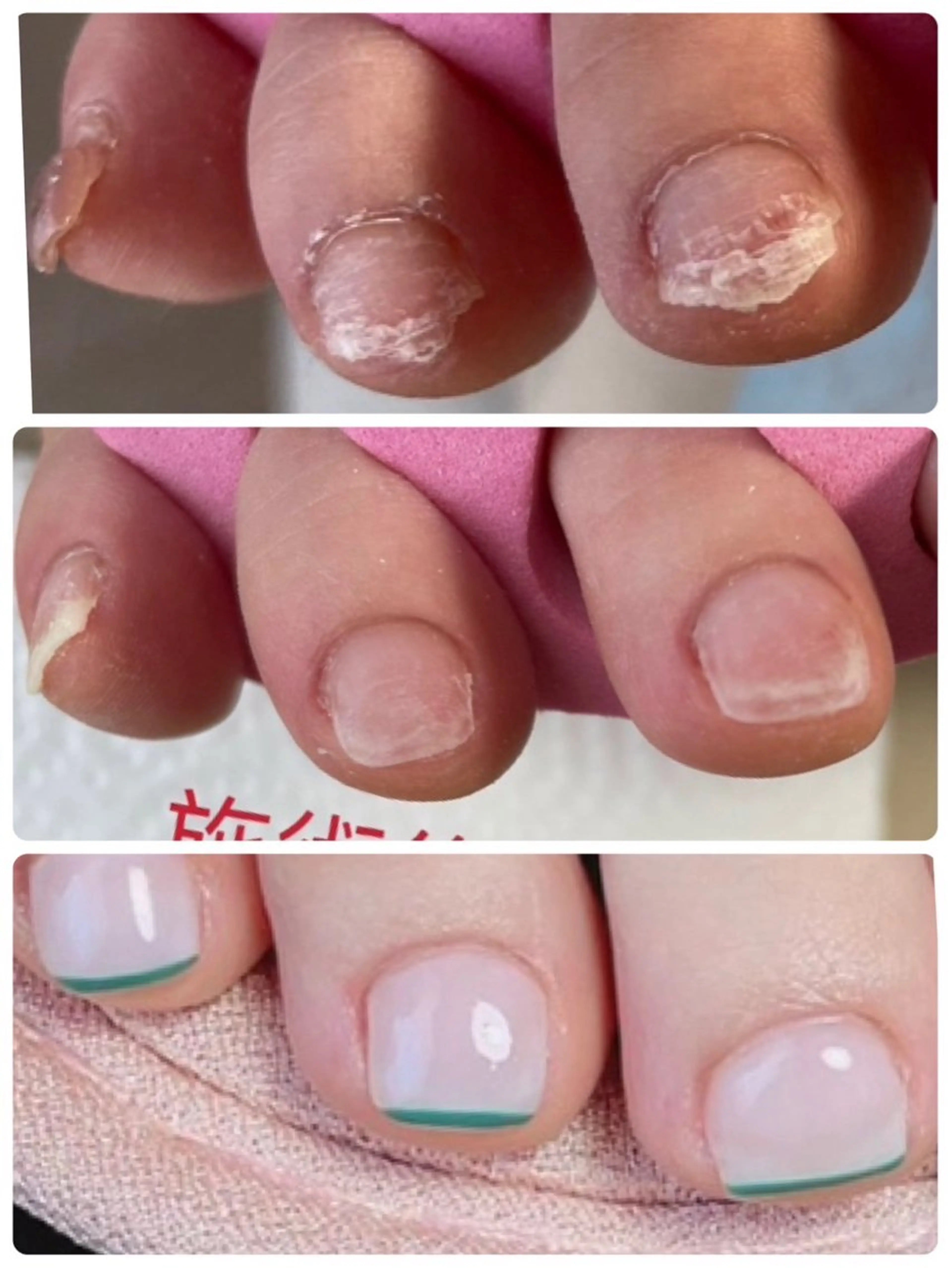 ネイル フットネイル Ai Nailのネイルデザイン