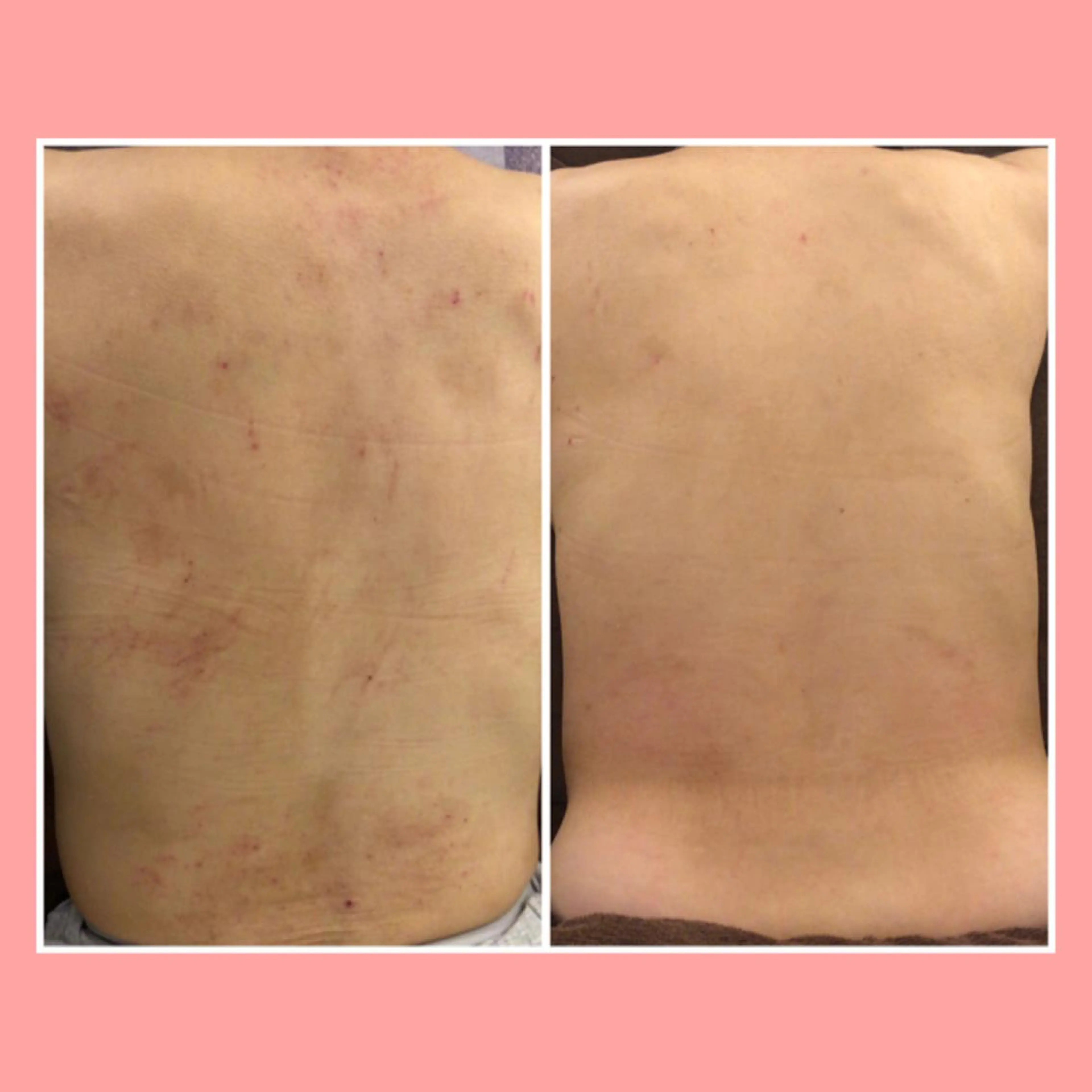 ショート カラー パーマ ヘアアレンジ メンズ キッズ ネイル マツエク・マツパ エステ リラク ニキビ・肌質改善専門 ♡人生が変わるサロンのエステ・リラクイメージ