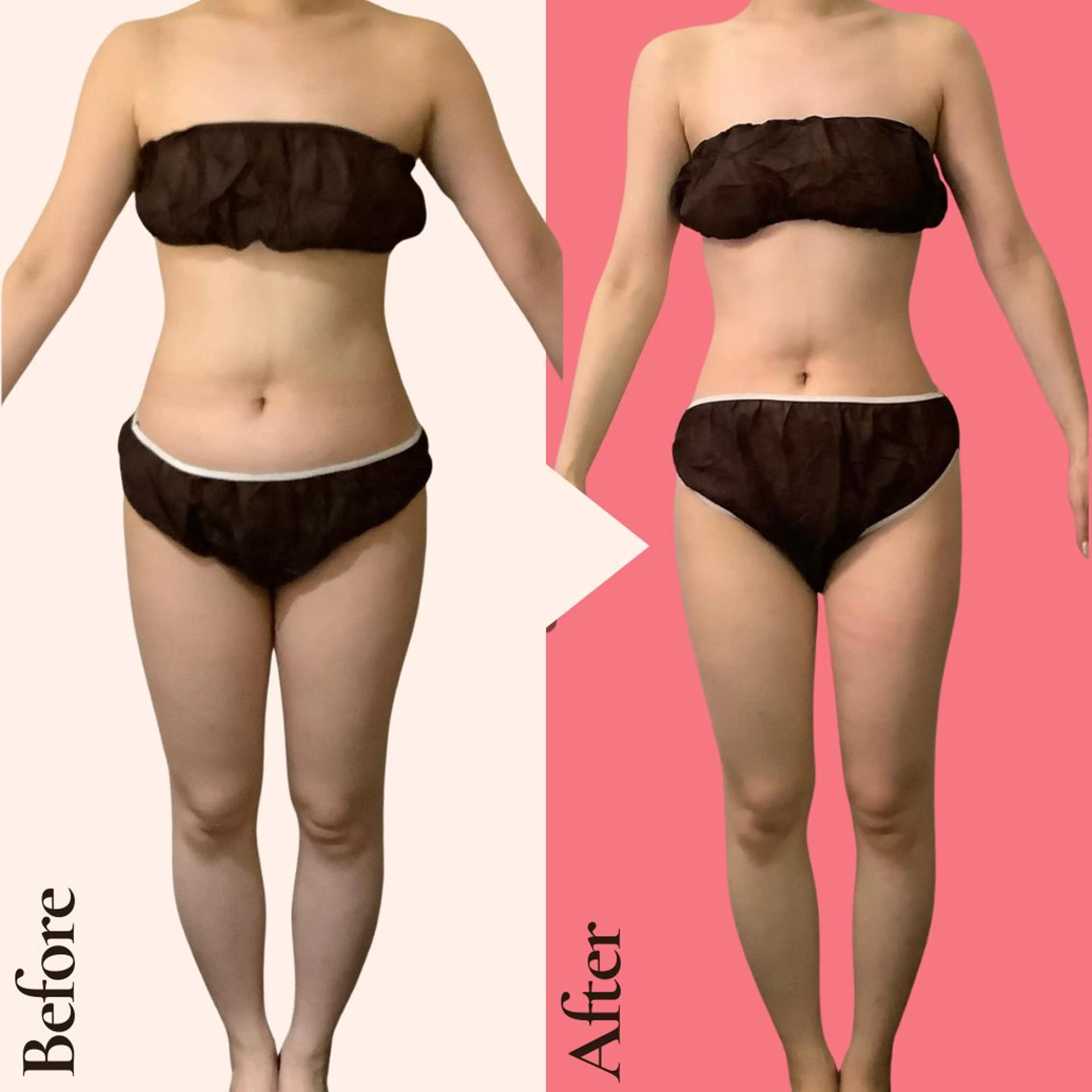 エステ リラク 痩身ダイエット専門店 プレシャスのエステ・リラクイメージ