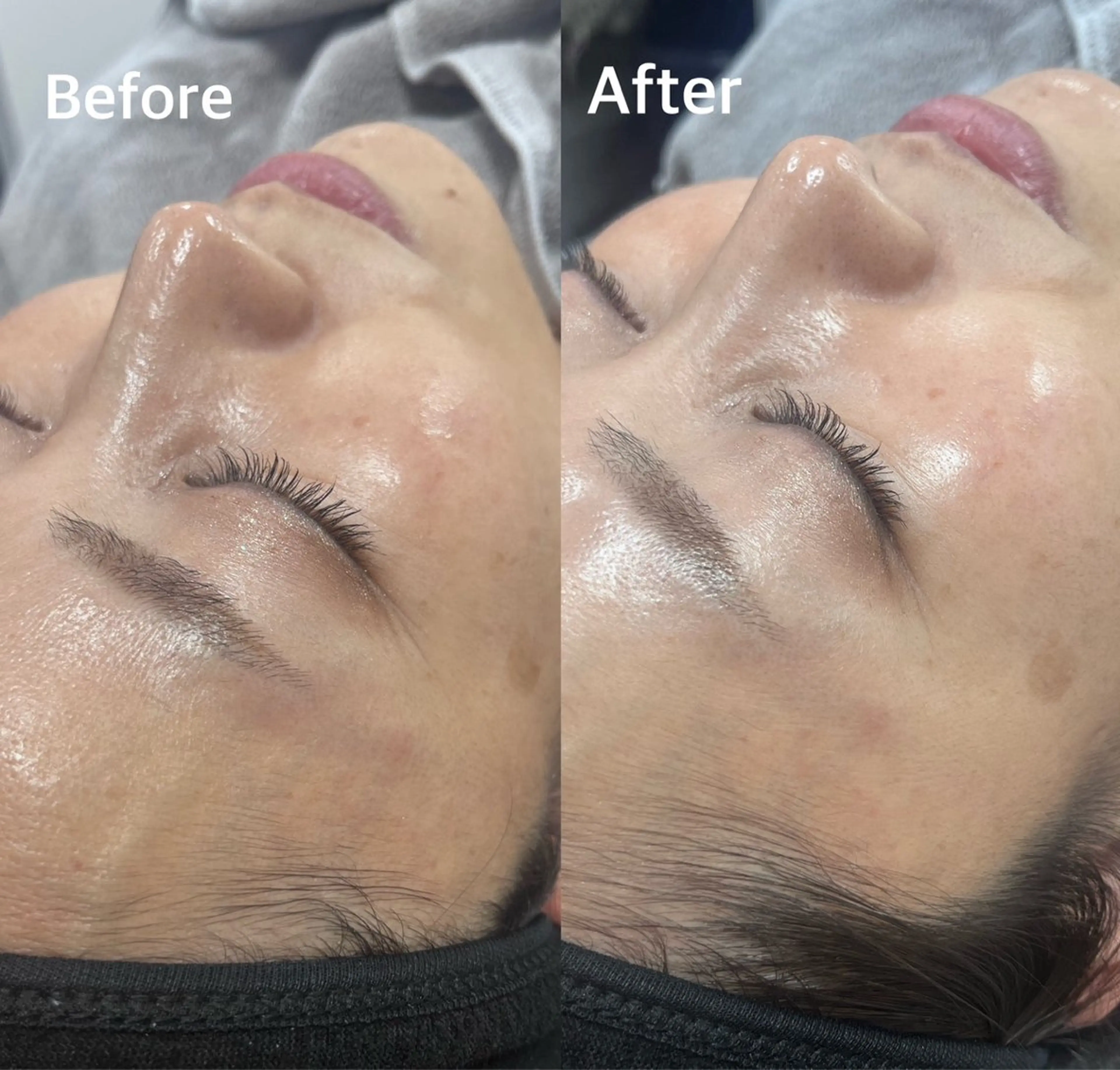 韓国式肌管理 ララピール専門のエステ・リラクイメージ