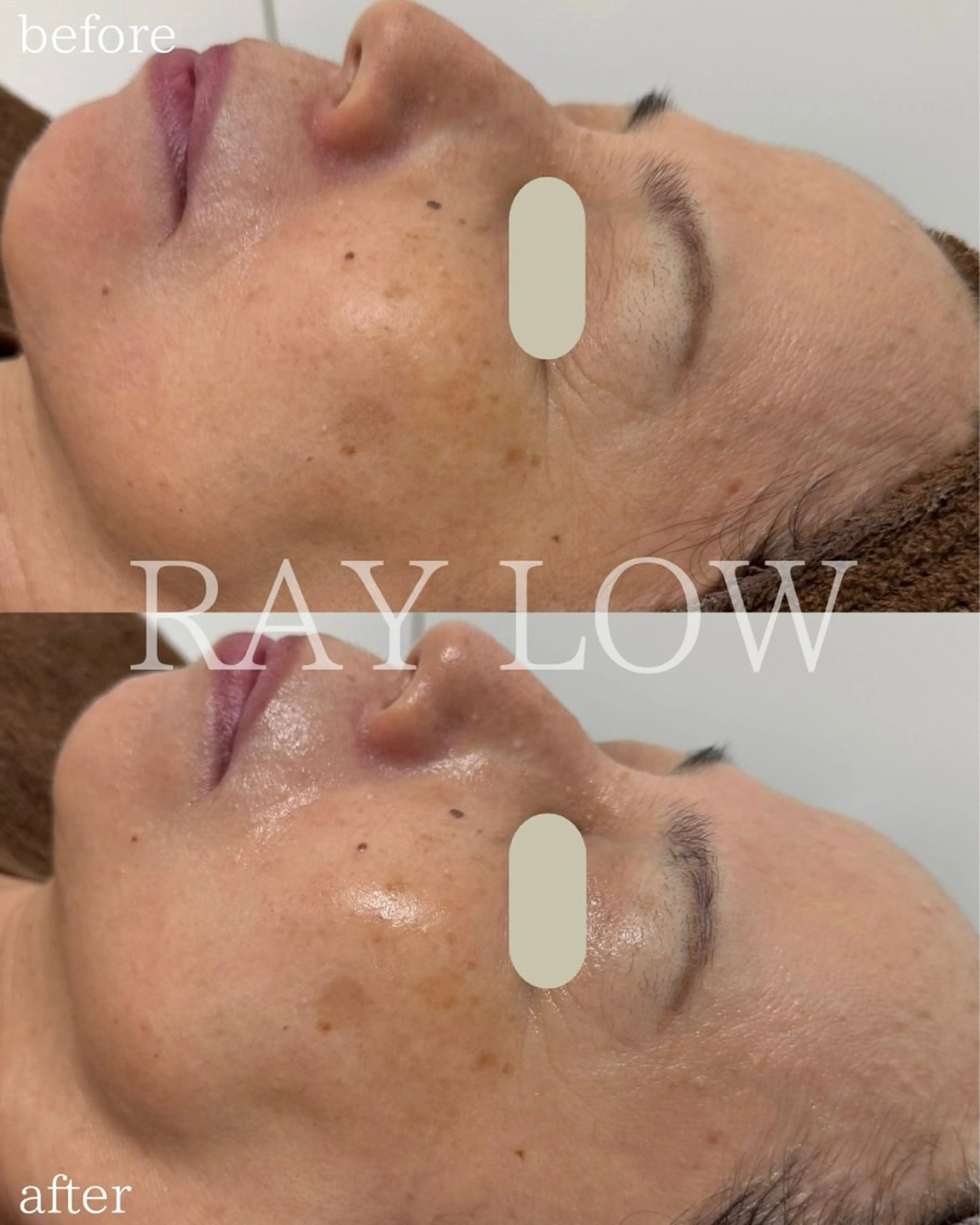 エステ RAY LOW所属・RAY LOW レイロウのエステ・リラクイメージ