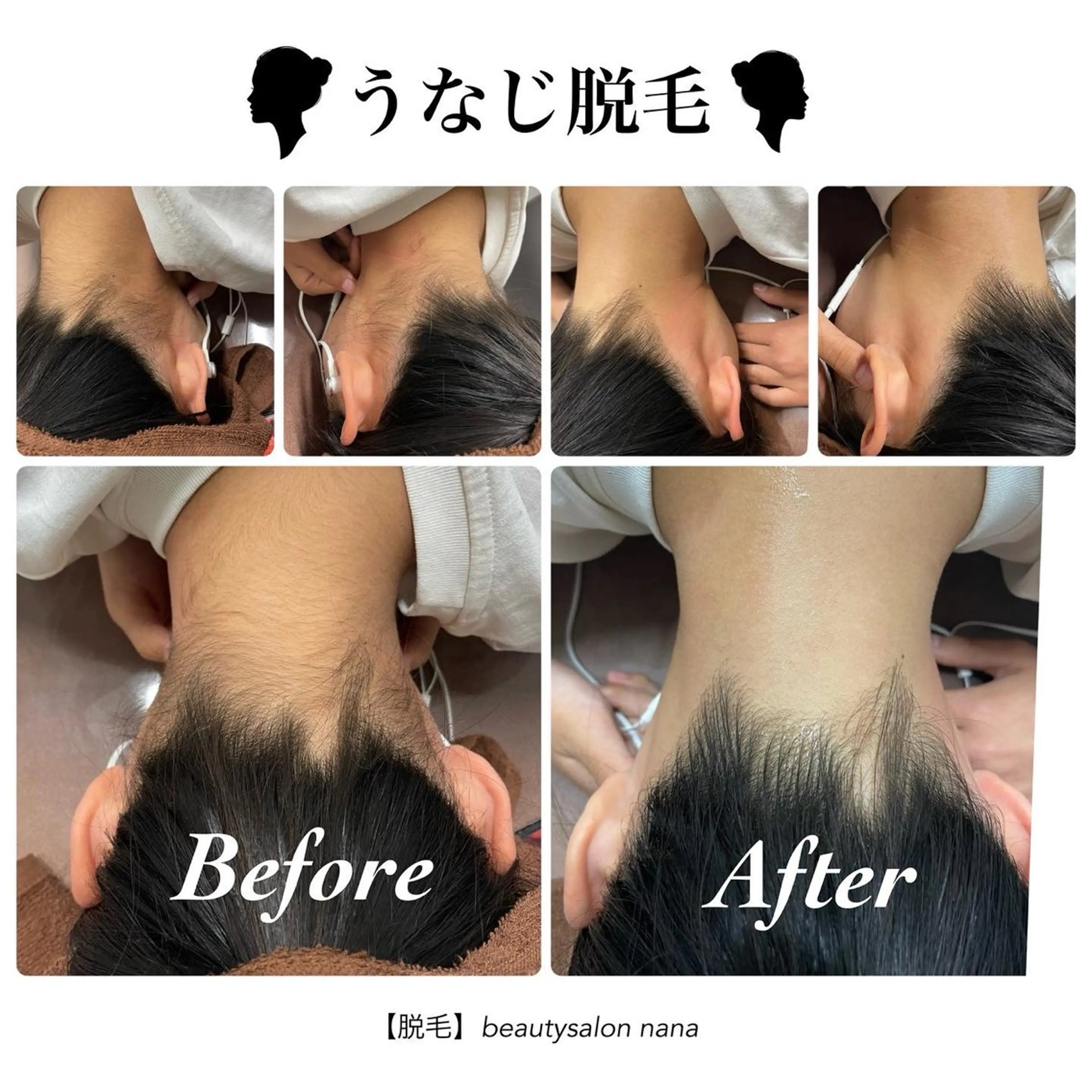 脱毛 beauty salon　nanaのエステ・リラクイメージ