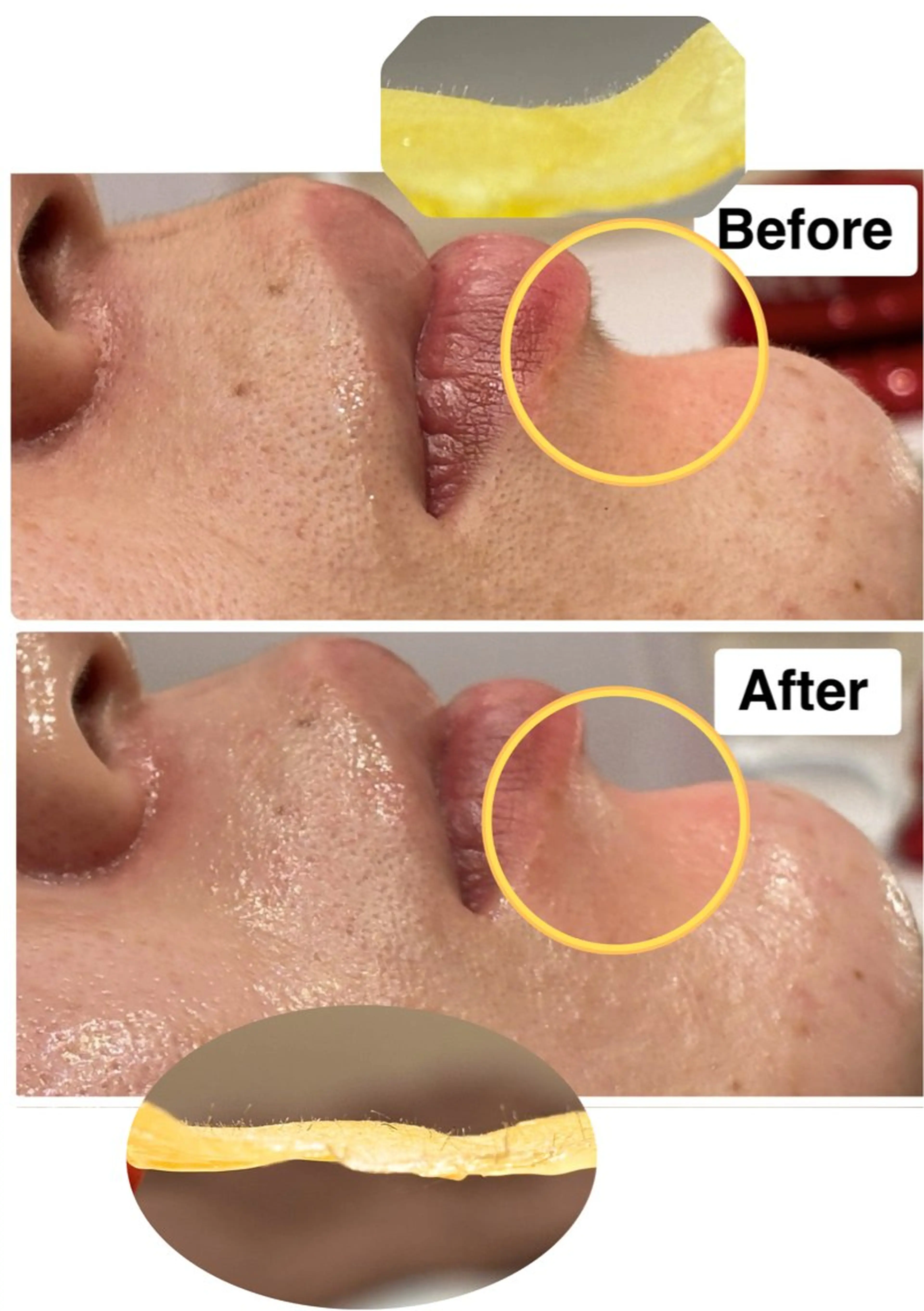 エステ 美肌脱毛サロン muroのエステ・リラクイメージ