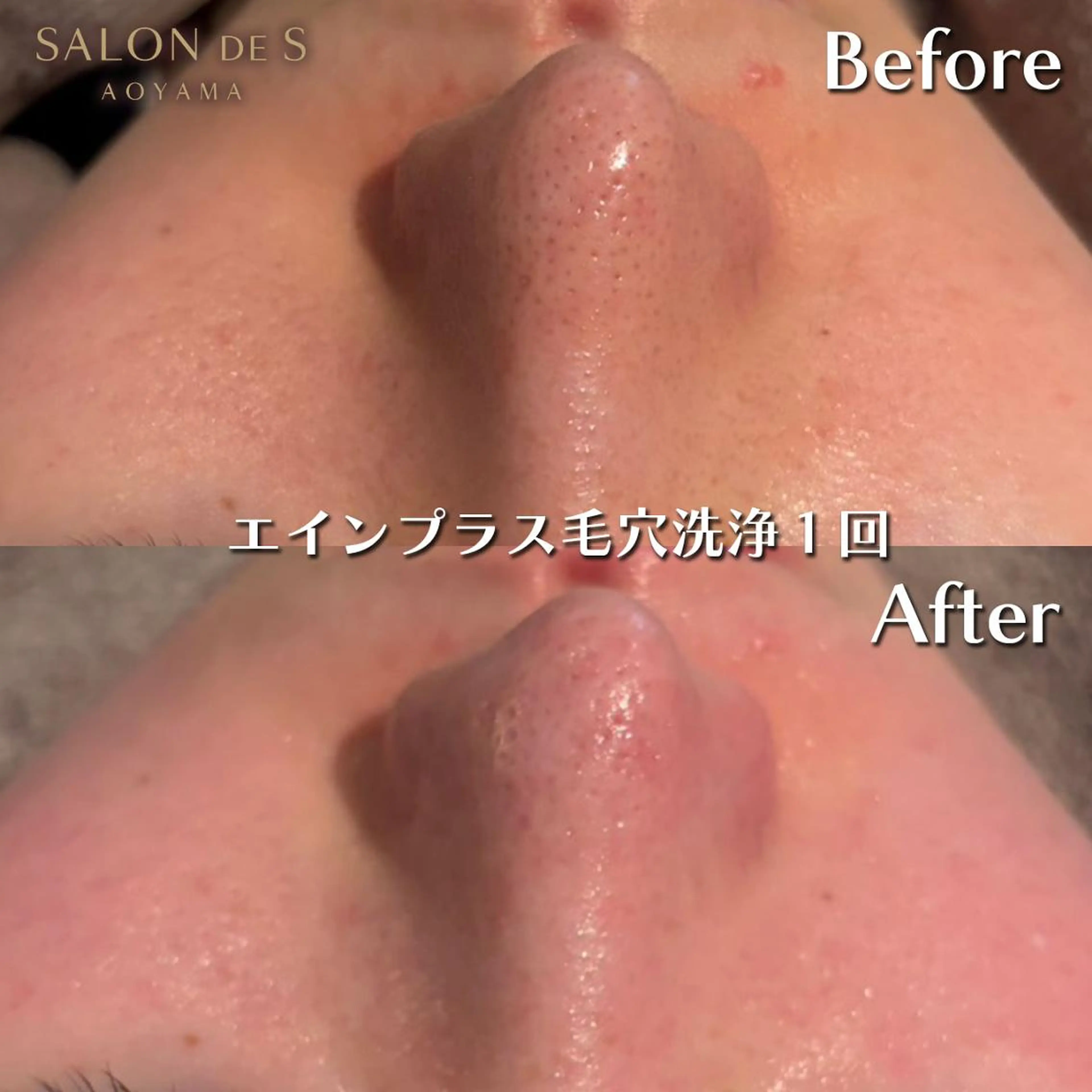 エステ SALON DE S 外苑前♡さやかのエステ・リラクイメージ