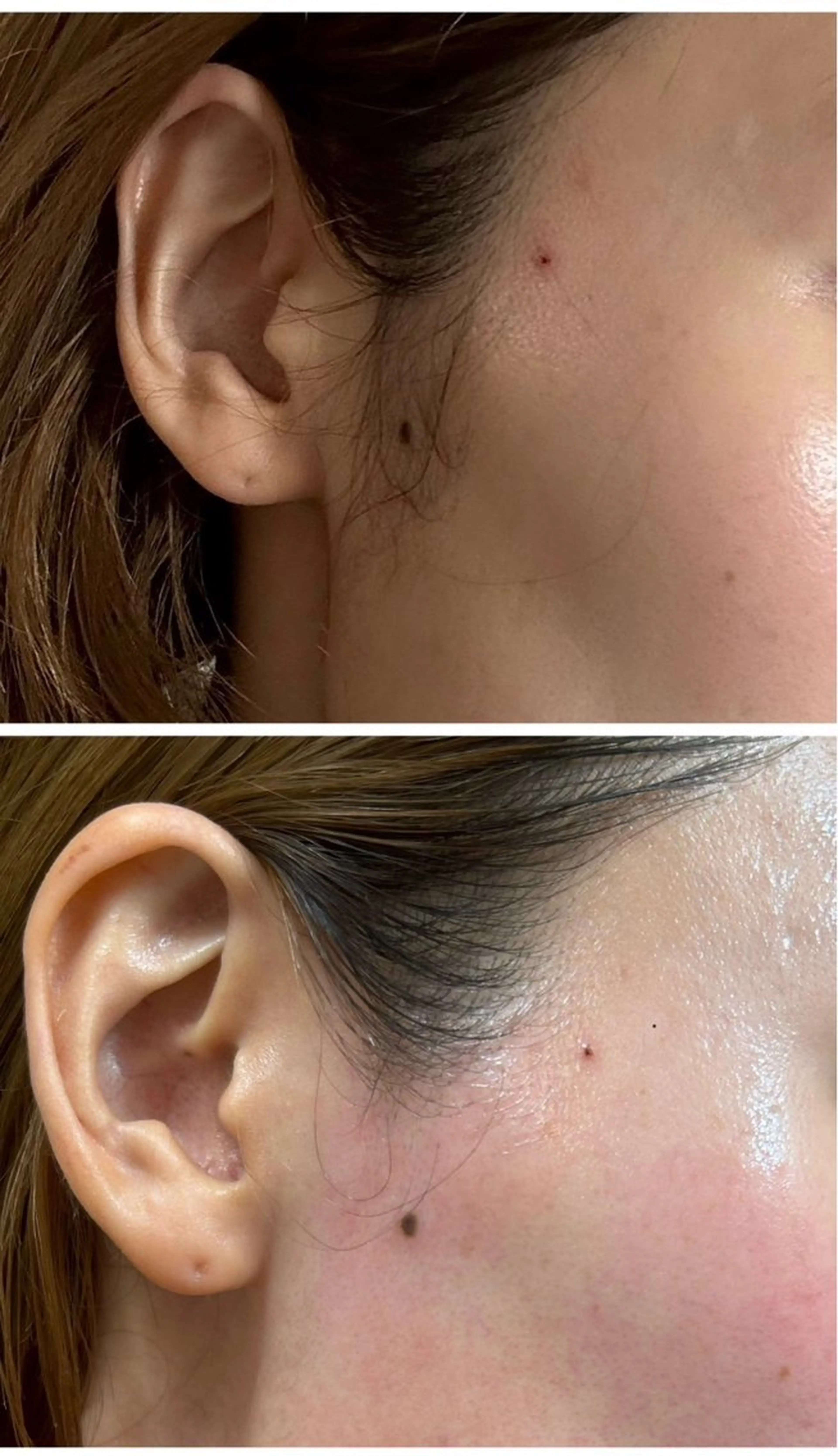 エステ beauty  salon sorelle所属・産毛角質ケア/艶肌 フェイシャルワックスのエステ・リラクイメージ