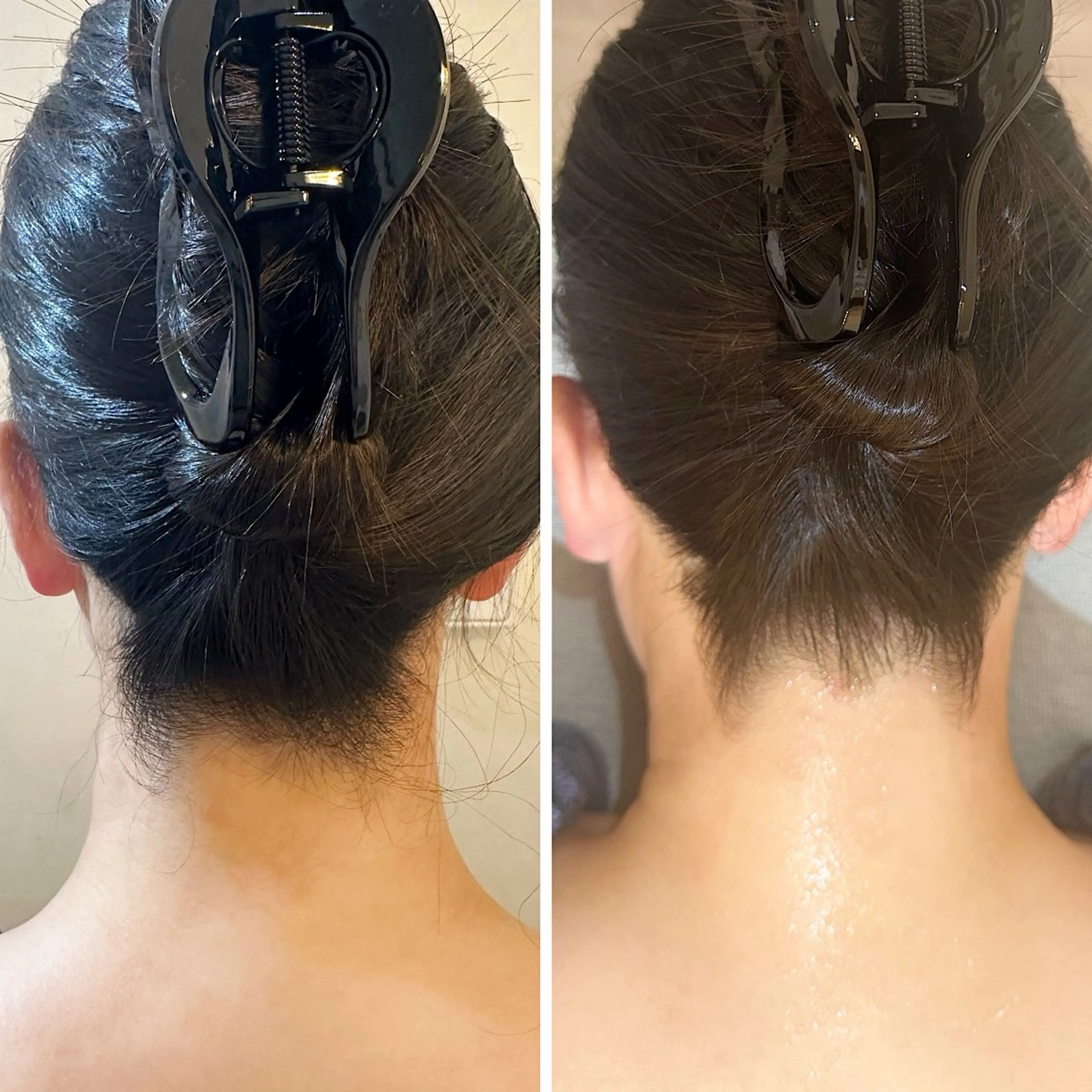 脱毛 うなじ脱毛/美肌脱毛 LABELのエステ・リラクイメージ