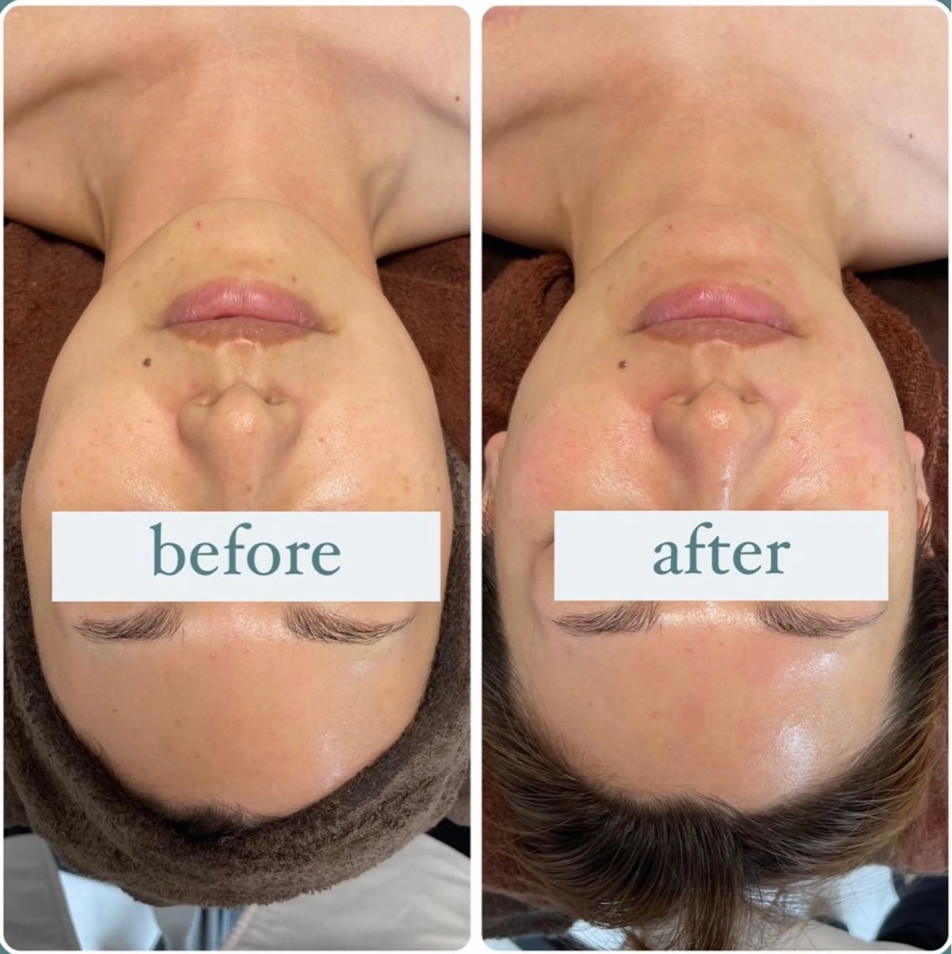 立体小顔×艶肌×美ボ ディ似合わせ施術 岡のエステ・リラクイメージ