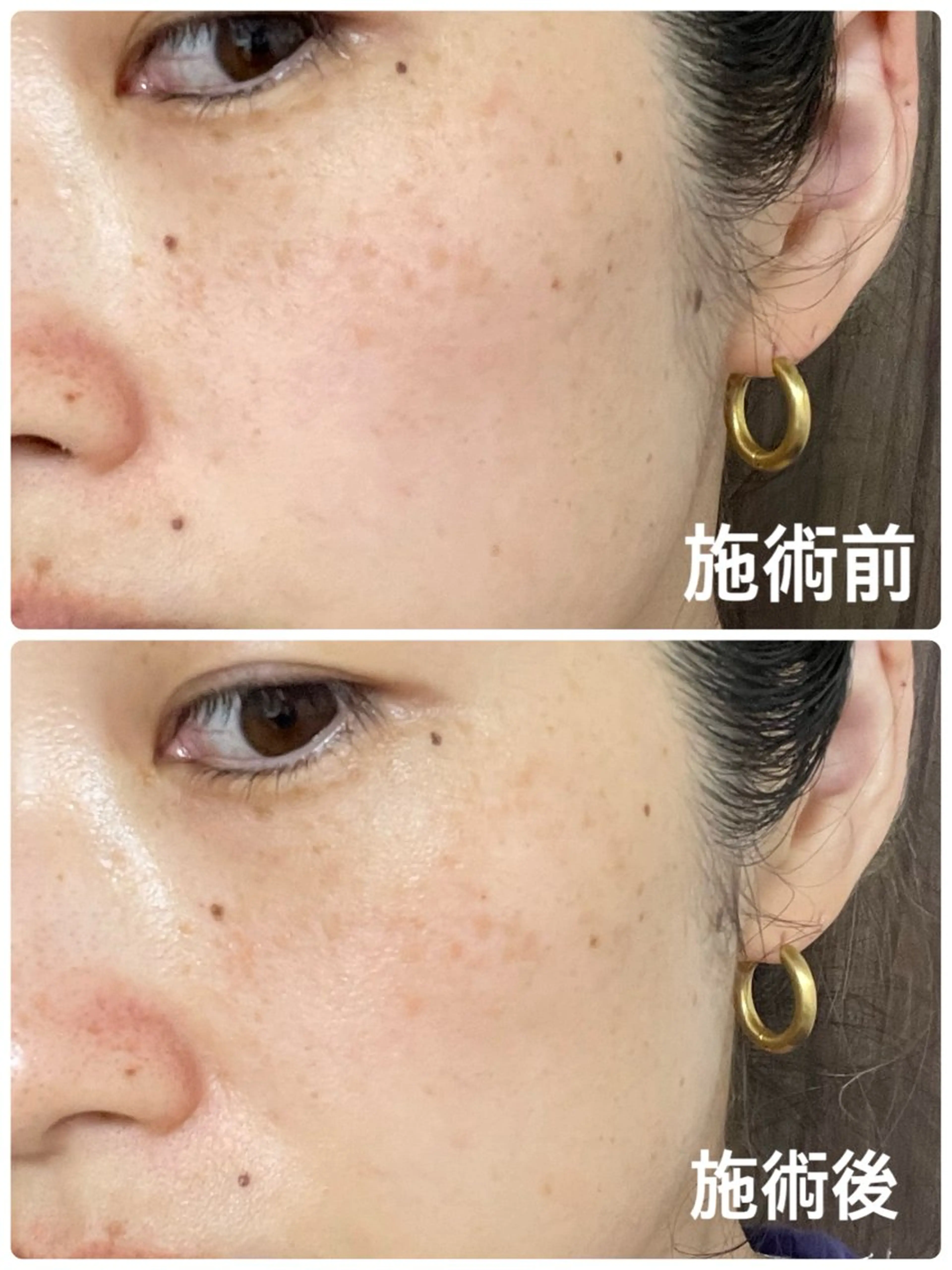 坂田(山下) 澄香のネイルデザイン