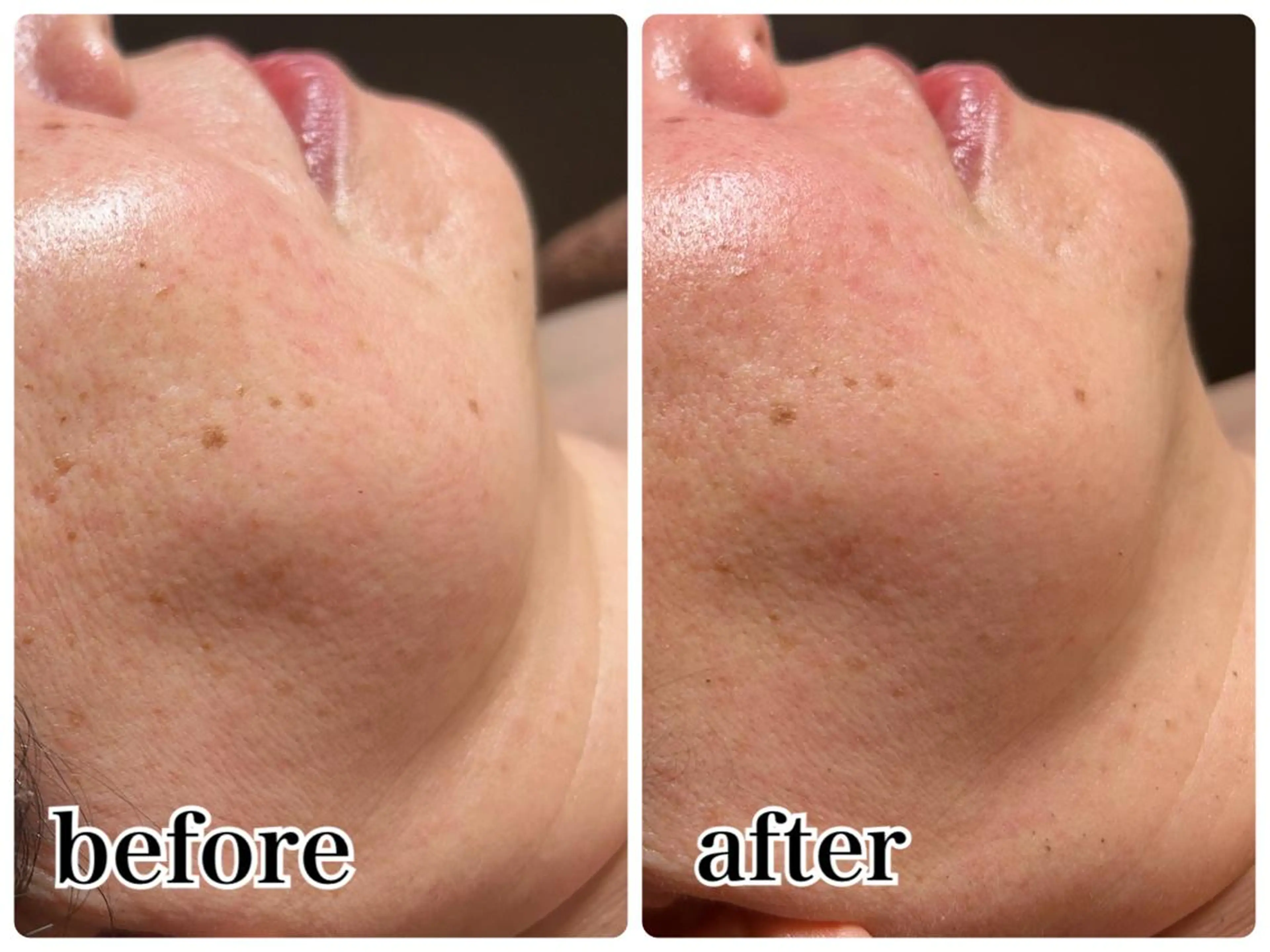 エステ Gemini 　MIKIのエステ・リラクイメージ