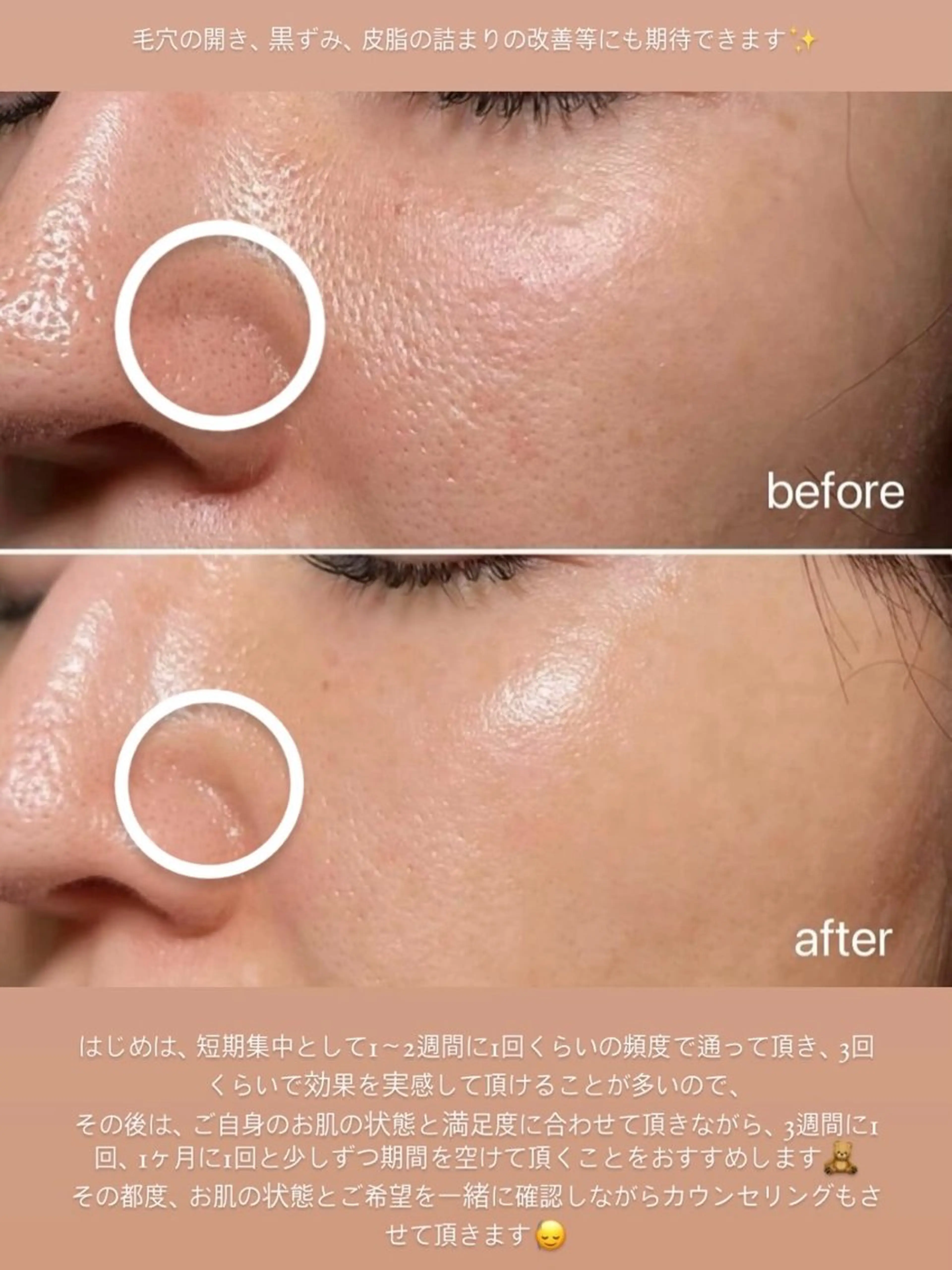 エステ ナスサロasuka. 🕯️🤎のエステ・リラクイメージ