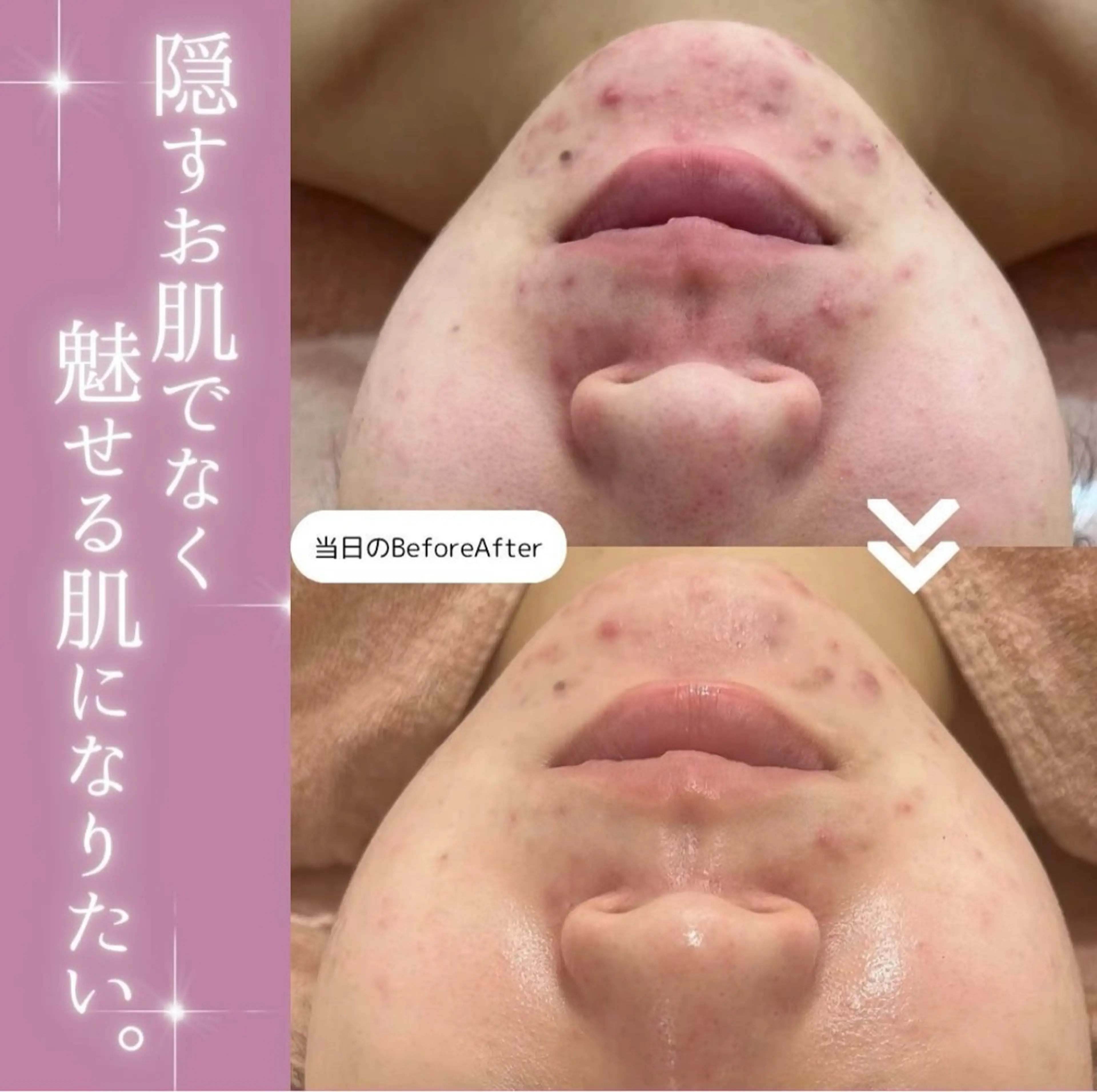 【現役看護師】高来 笑子のエステ・リラクイメージ