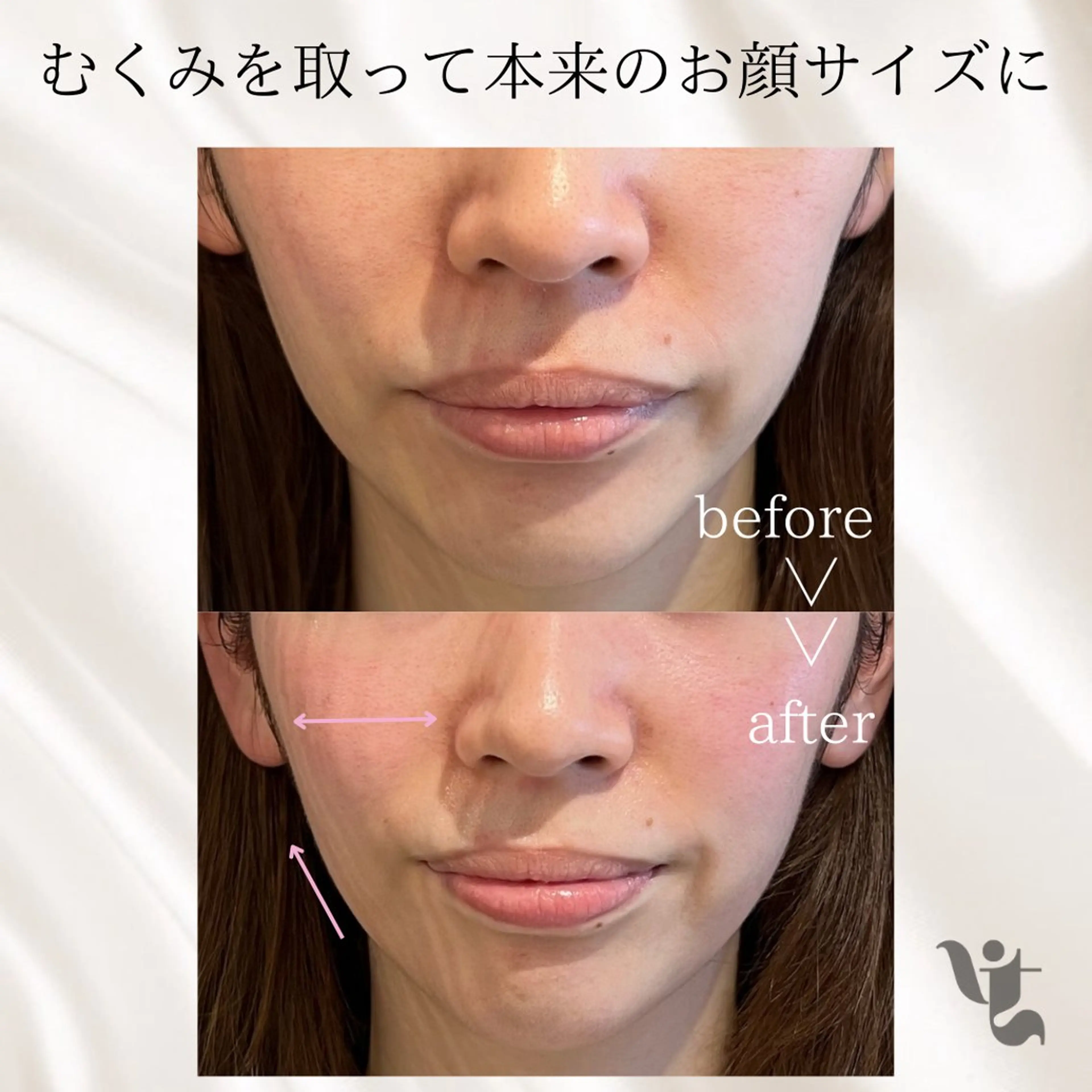 肌管理サロン vidyto　MOEのエステ・リラクイメージ