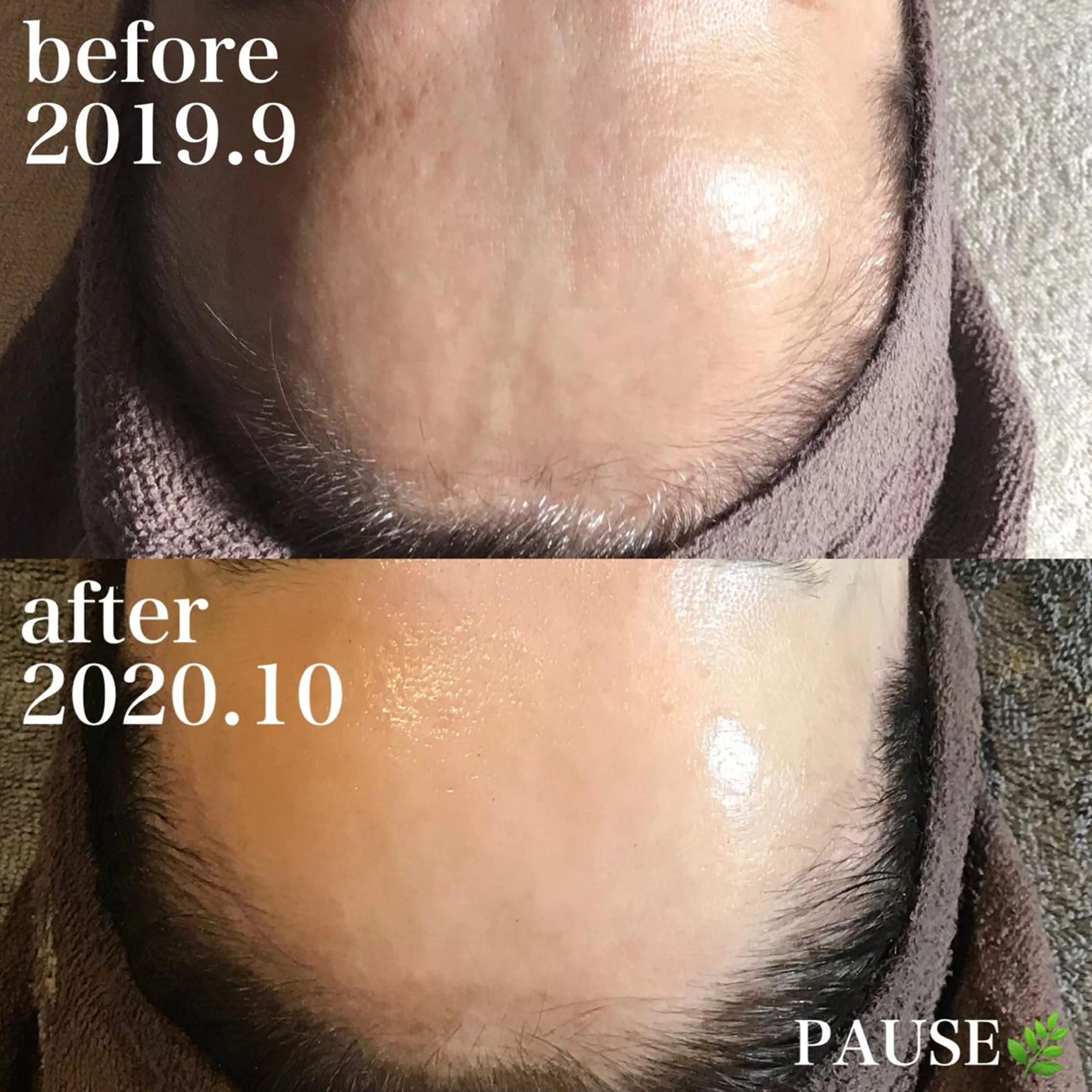 エステ 浜野 恵美のエステ・リラクイメージ