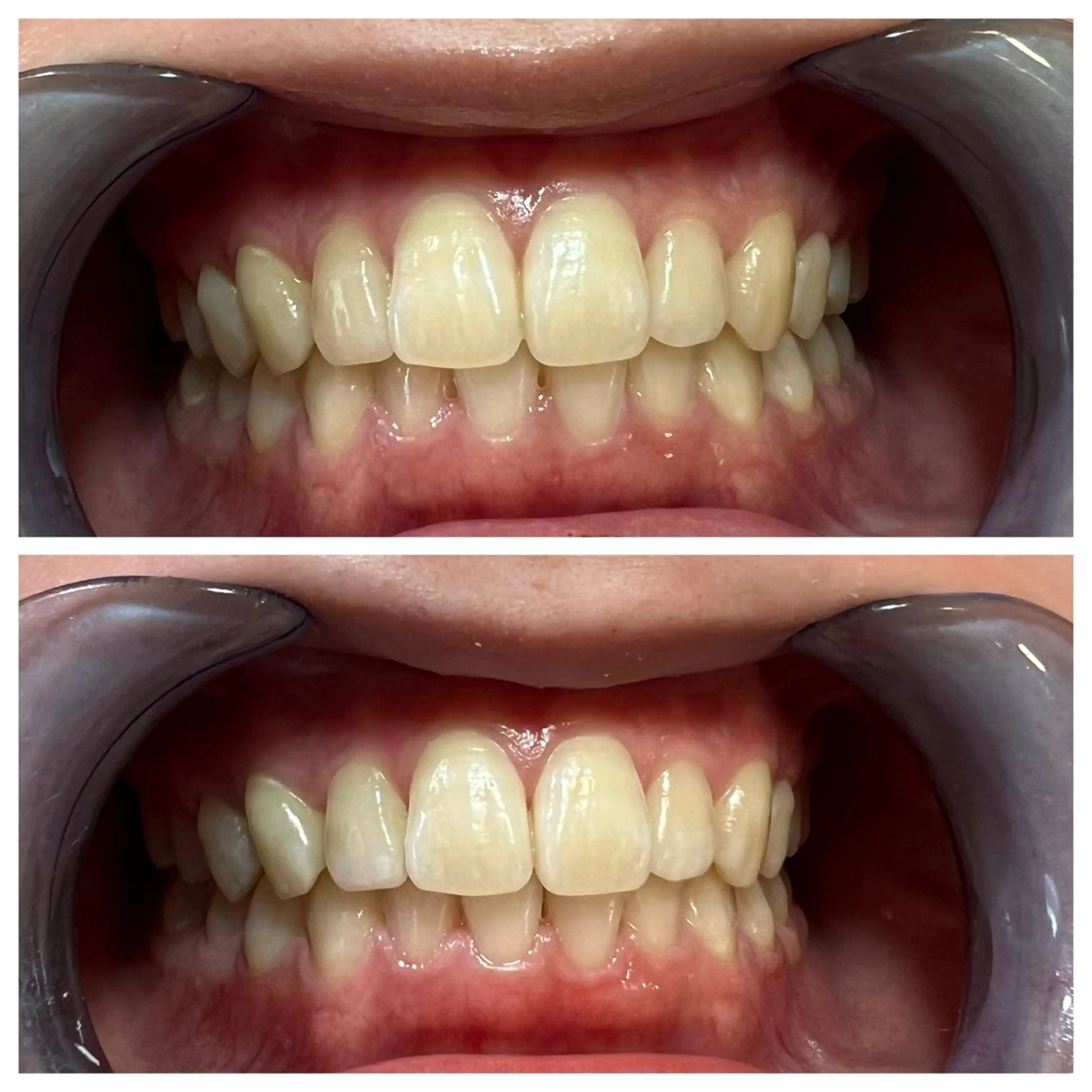 セルフホワイトニング Shineeのエステ・リラクイメージ