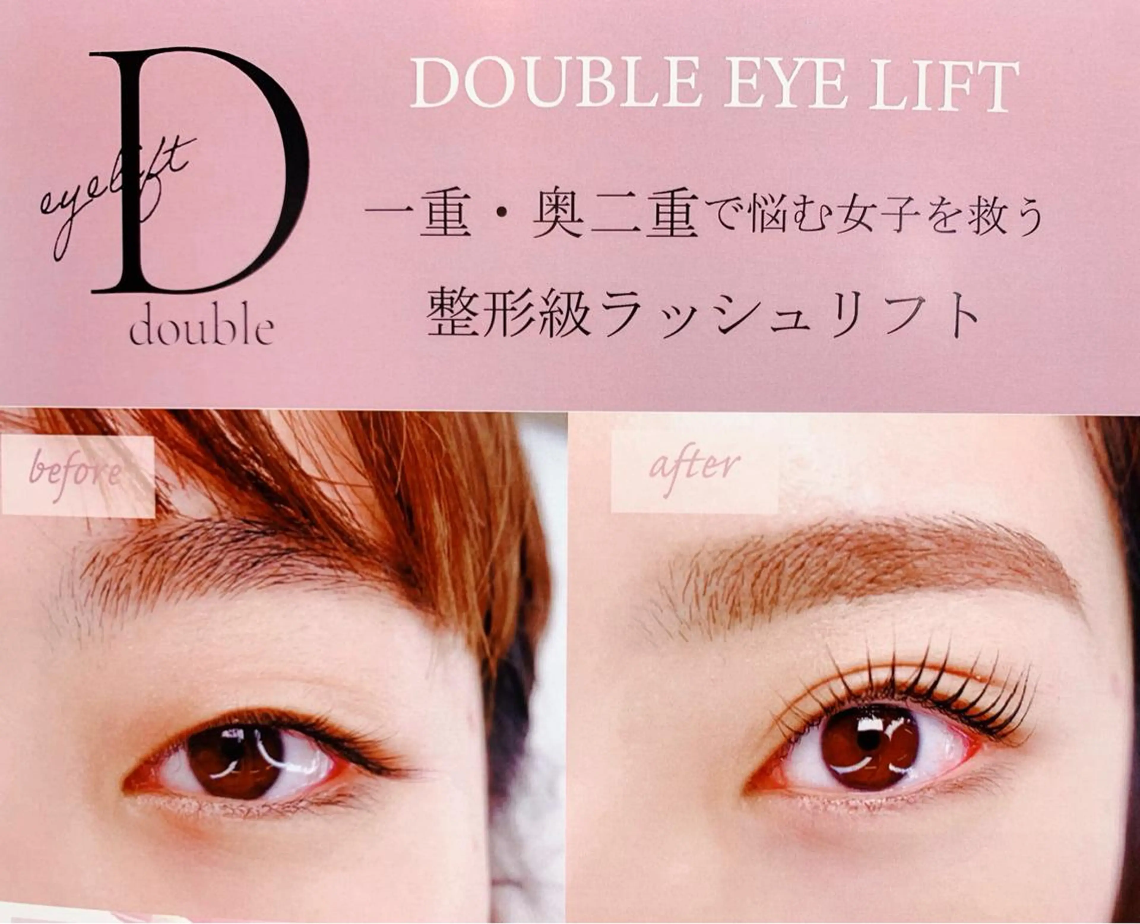 🉐20%OFF 四日市初！整形級ラッシュリフト♡ダブルアイリフト 三重県では導入は2店舗のみの最新技術の写真