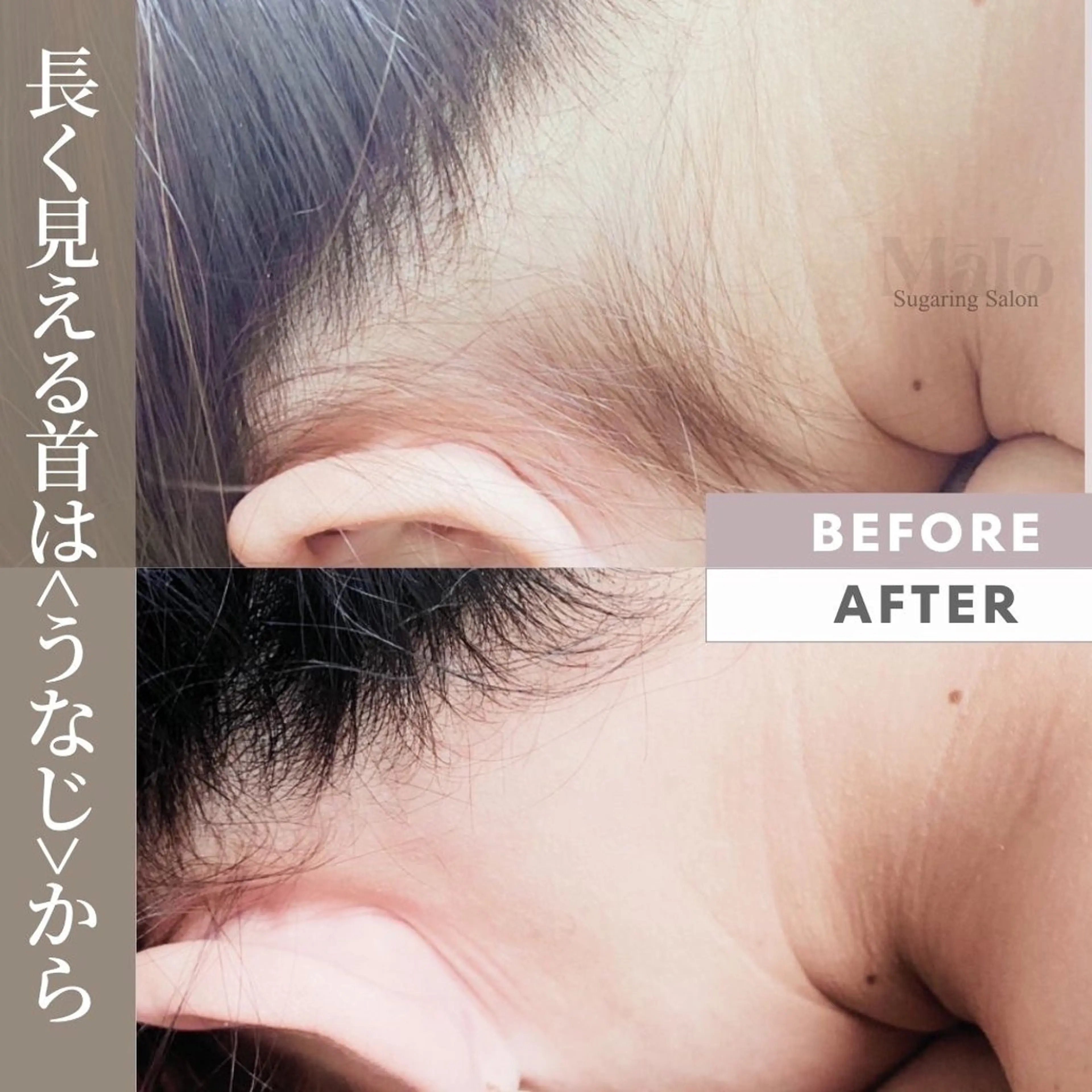 💎当店人気!!💎うなじ脱毛!!首が細長く見える!自信持って髪の毛アップできました!などのお声たくさん✨の写真