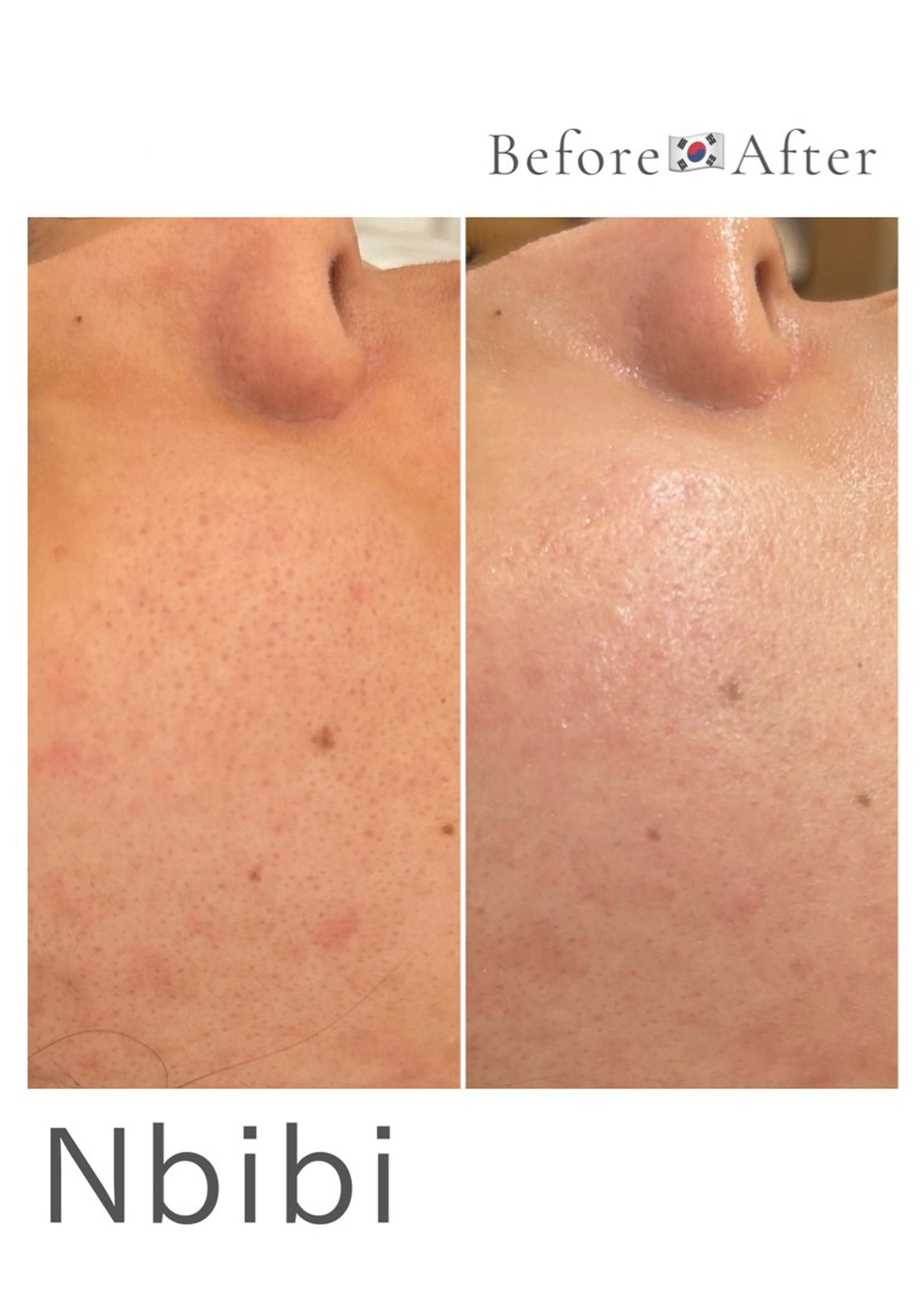 エステ 韓国🇰🇷価格 サロン_Nbibiの眉毛・アイブロウイメージ