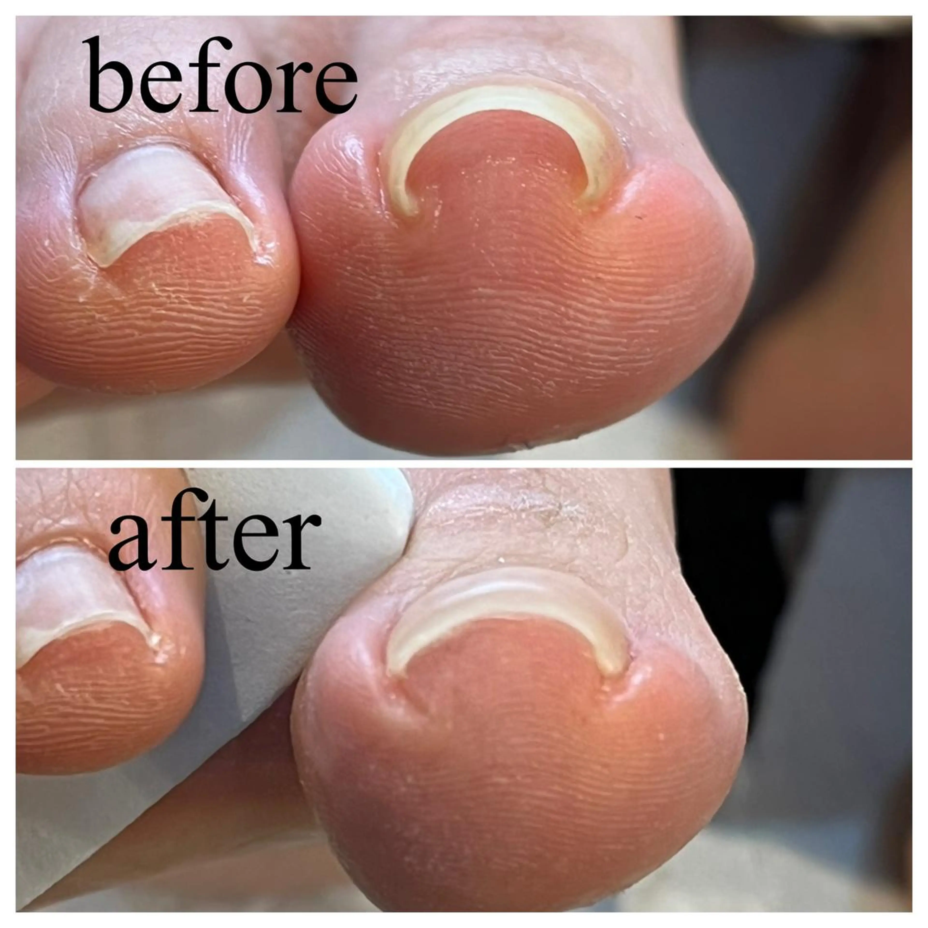 ネイル プライベートネイルサロン　i nail所属・プライベートサロン i nailのネイルデザイン