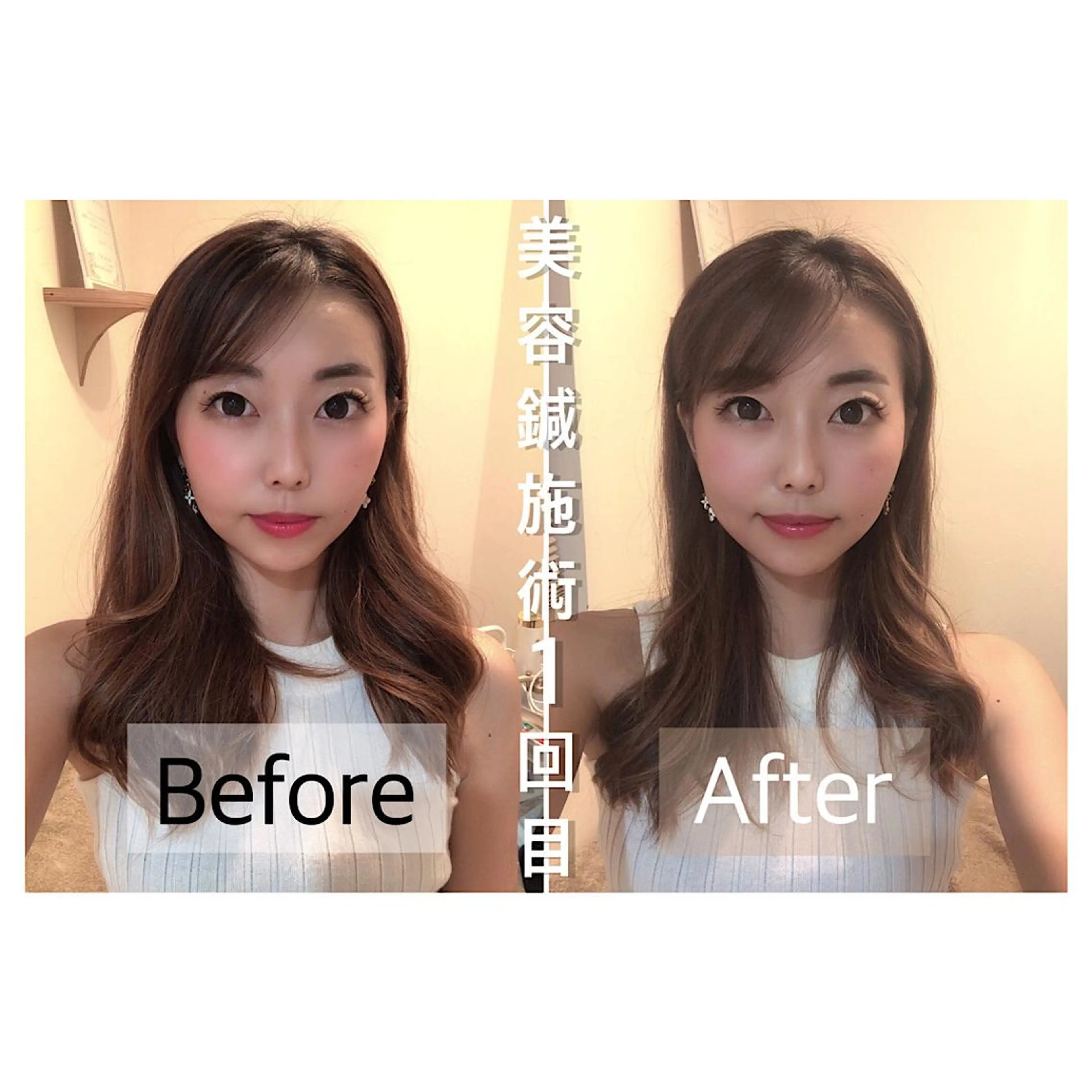 鍼灸 Refineのその他イメージ