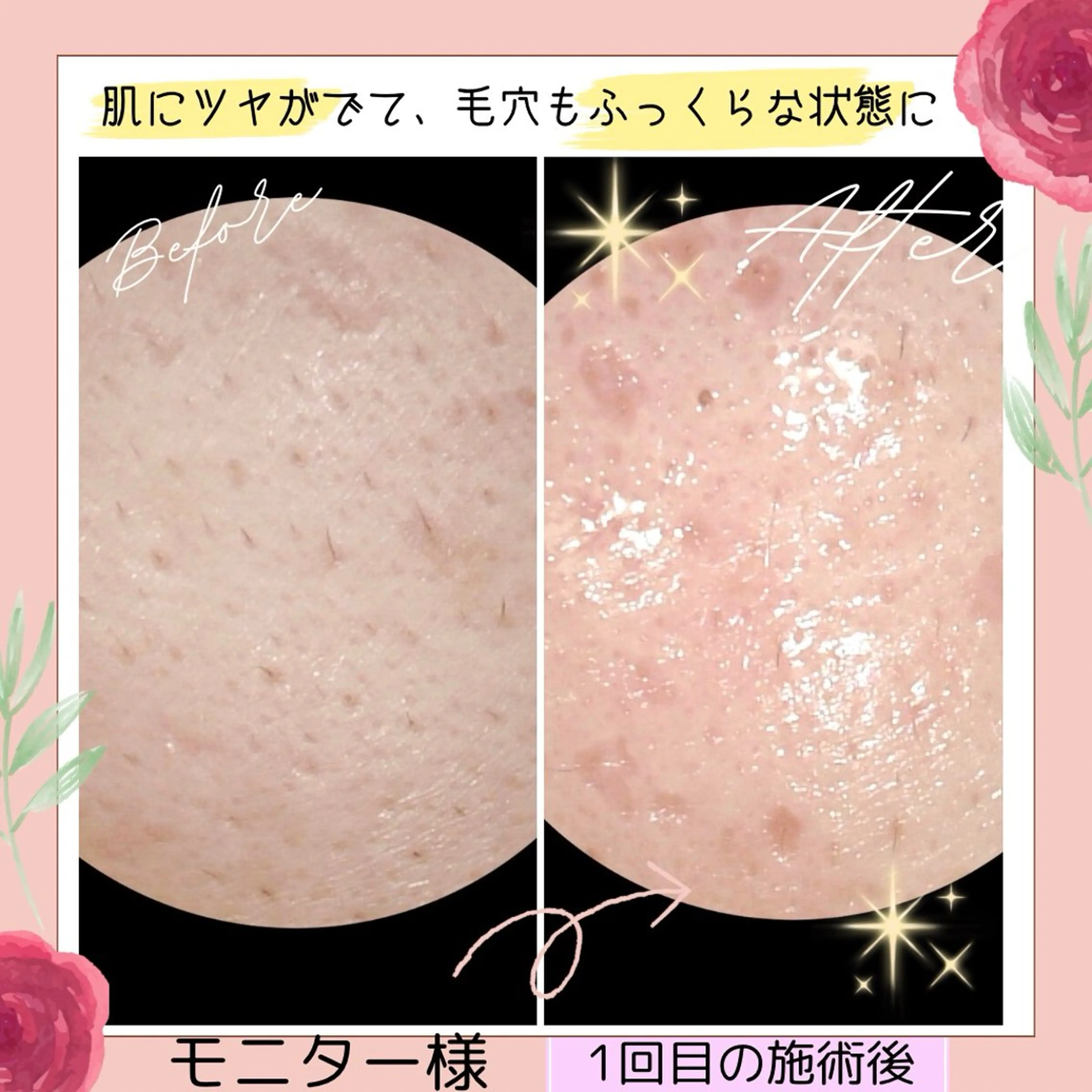 エステ リラク ペルラジョーネ💄 emiのエステ・リラクイメージ