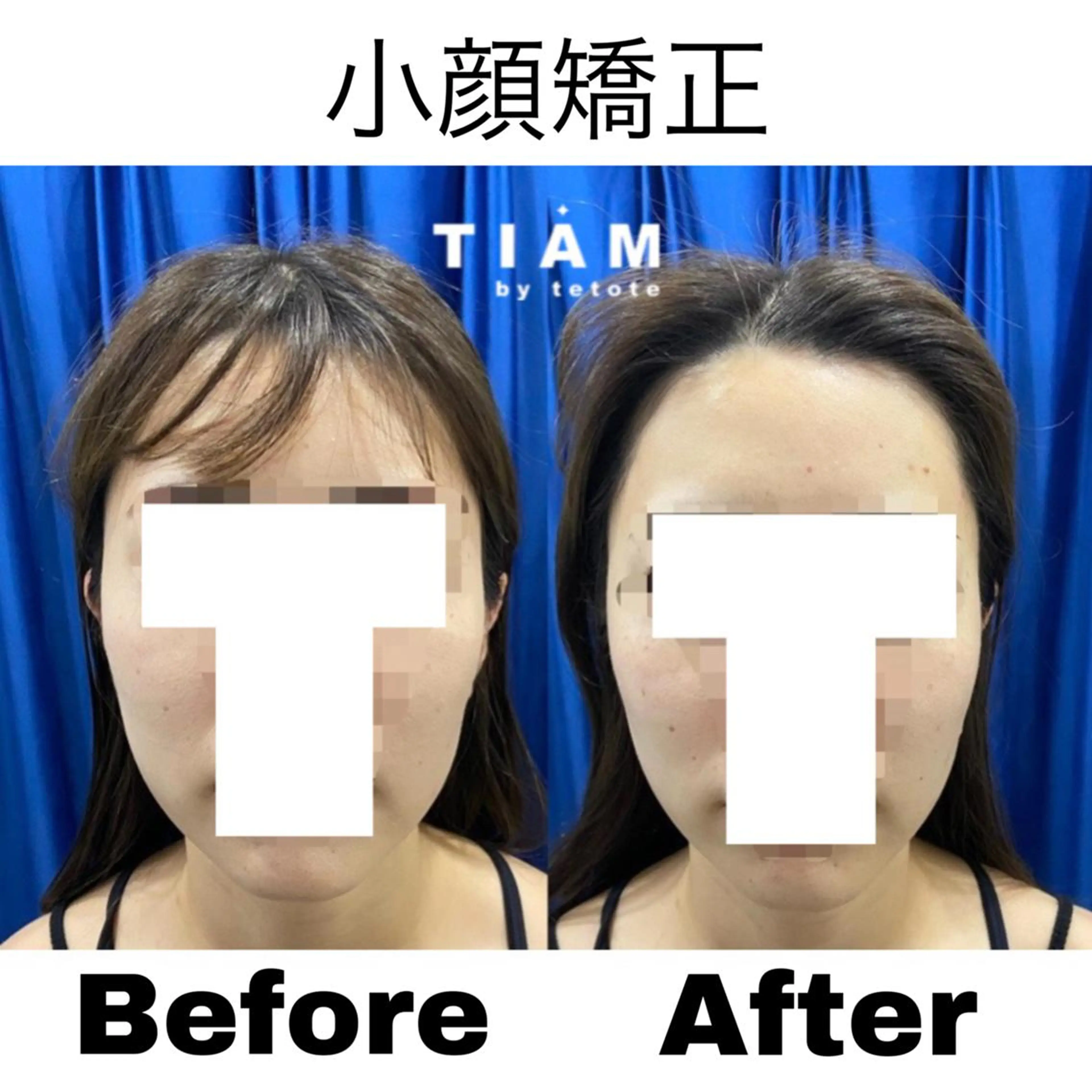 美肌サロンTIAM by tetoteのエステ・リラクイメージ