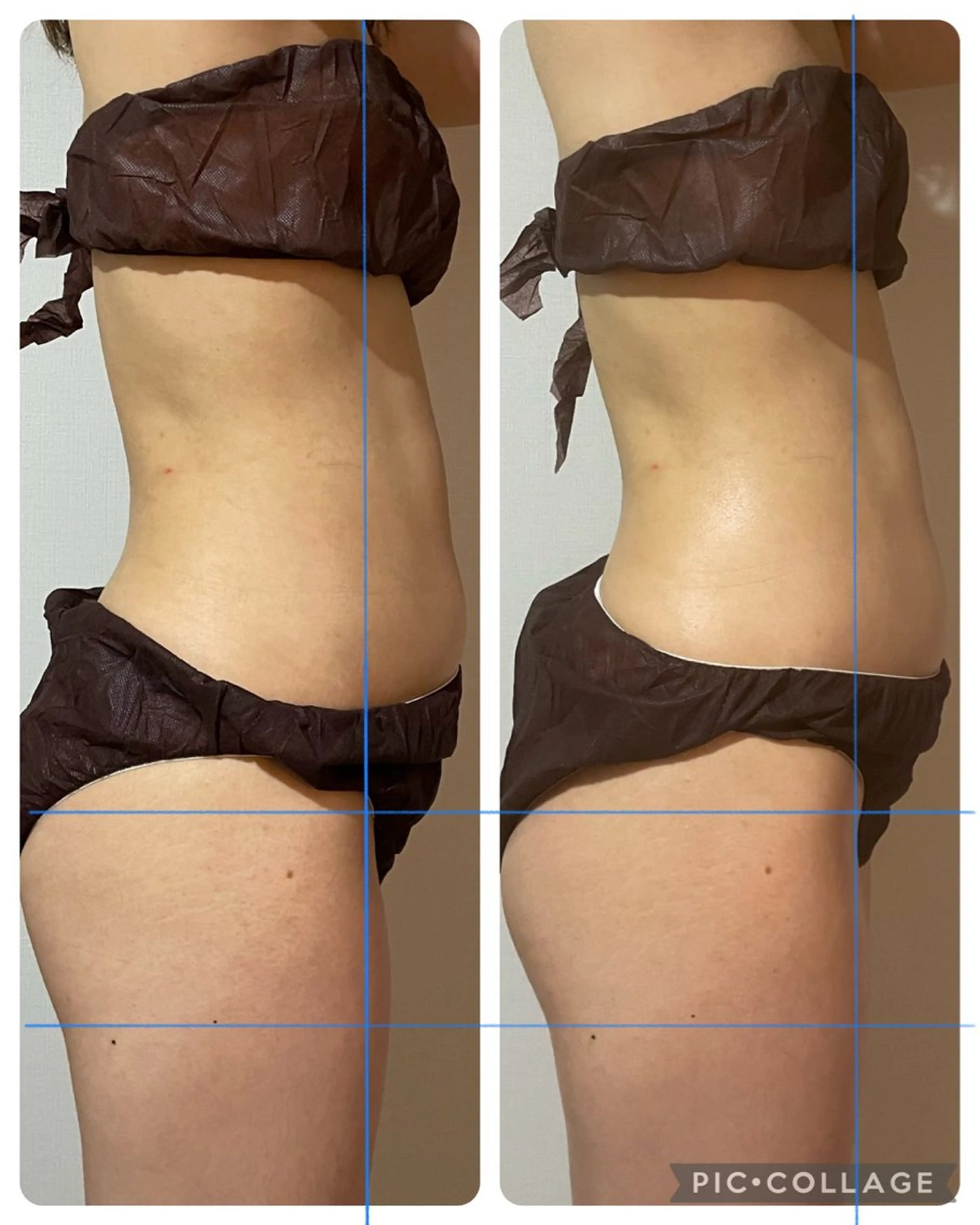 エステ リラク 癒し腸もみサロン シャユーム　ゆきなのエステ・リラクイメージ