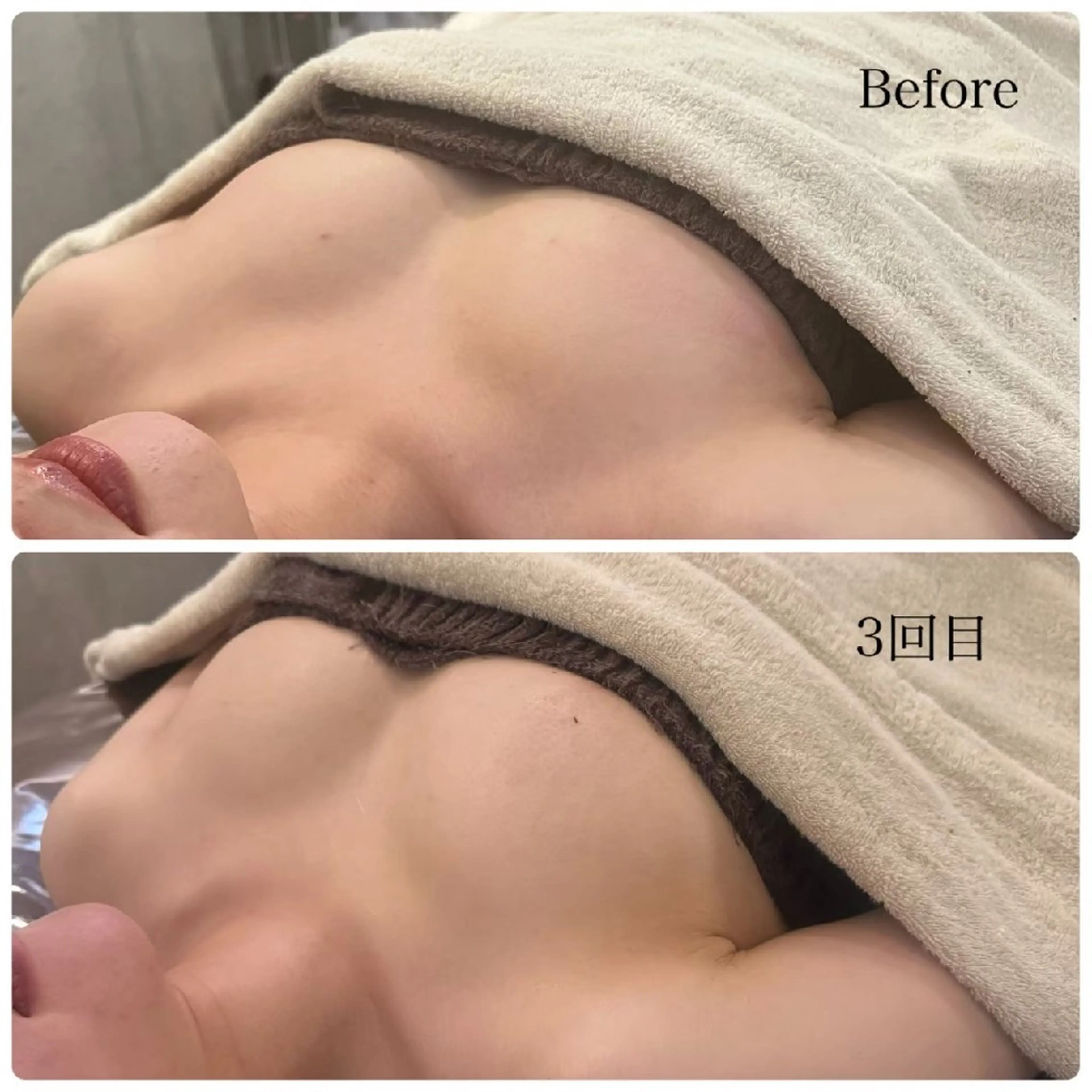 エステ バストアップ/育乳＆ アイブロウ MARIのエステ・リラクイメージ