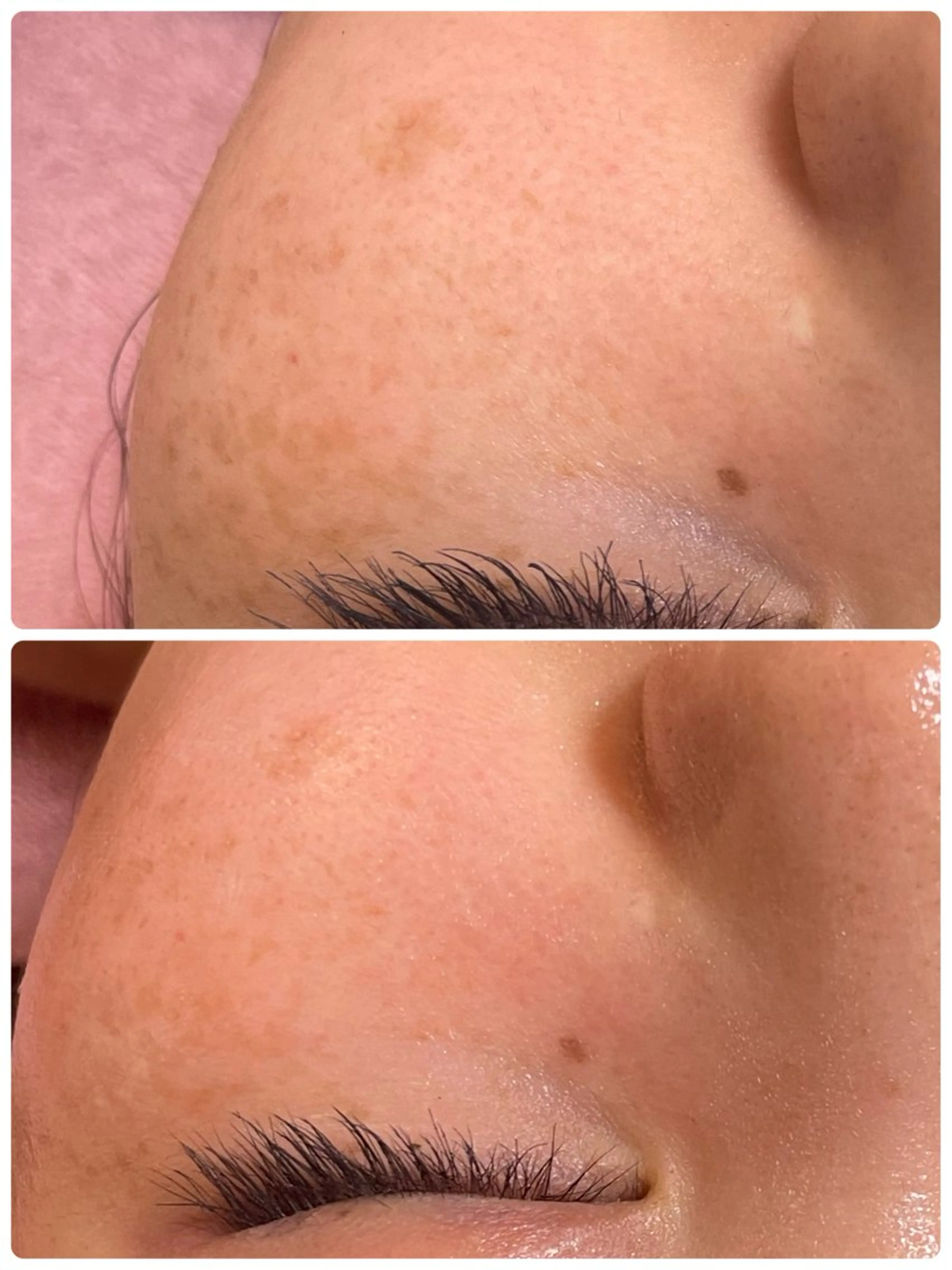 心満たされる ハーブピーリング絹々のエステ・リラクイメージ