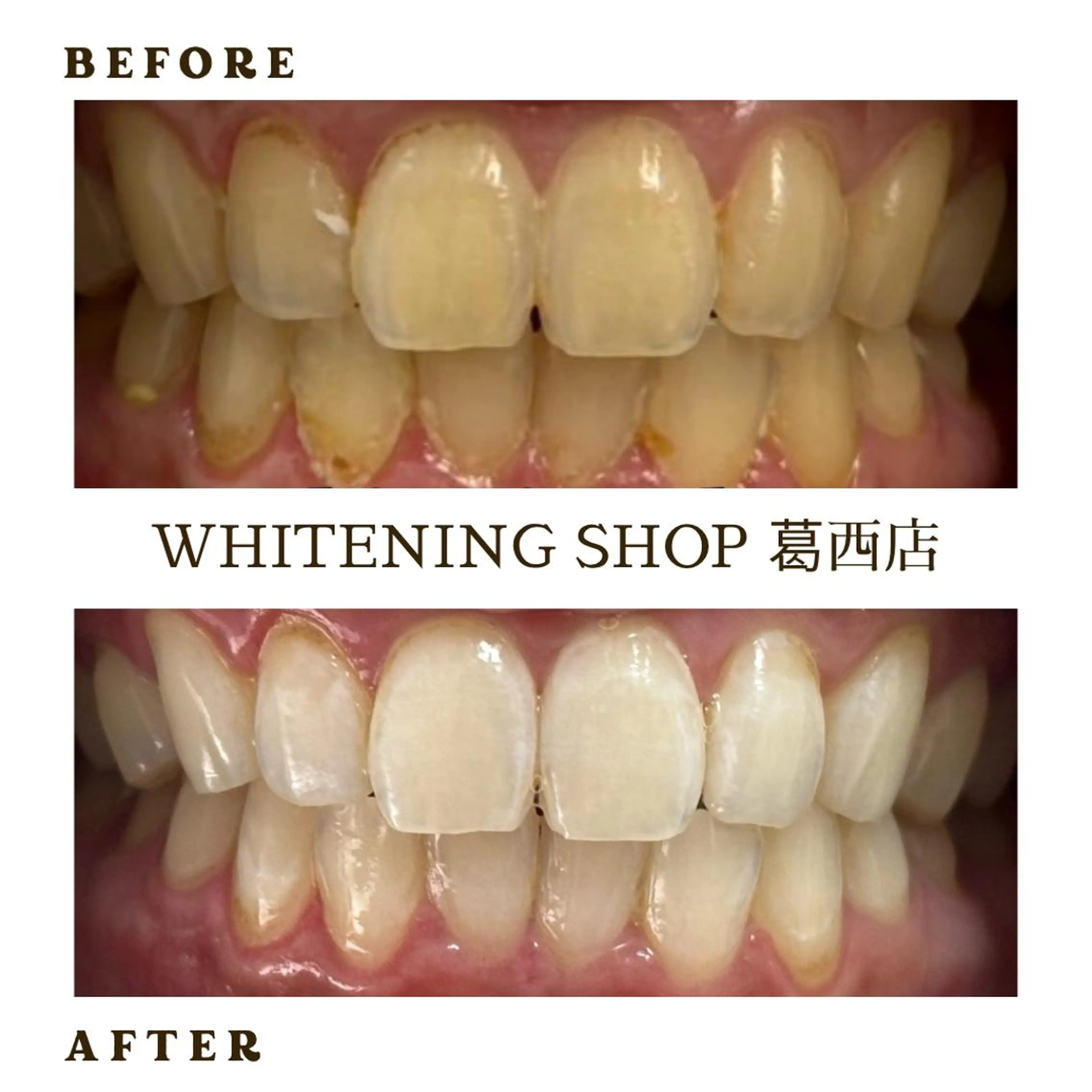 メンズ その他 ホワイトニング ショップ葛西店のその他イメージ