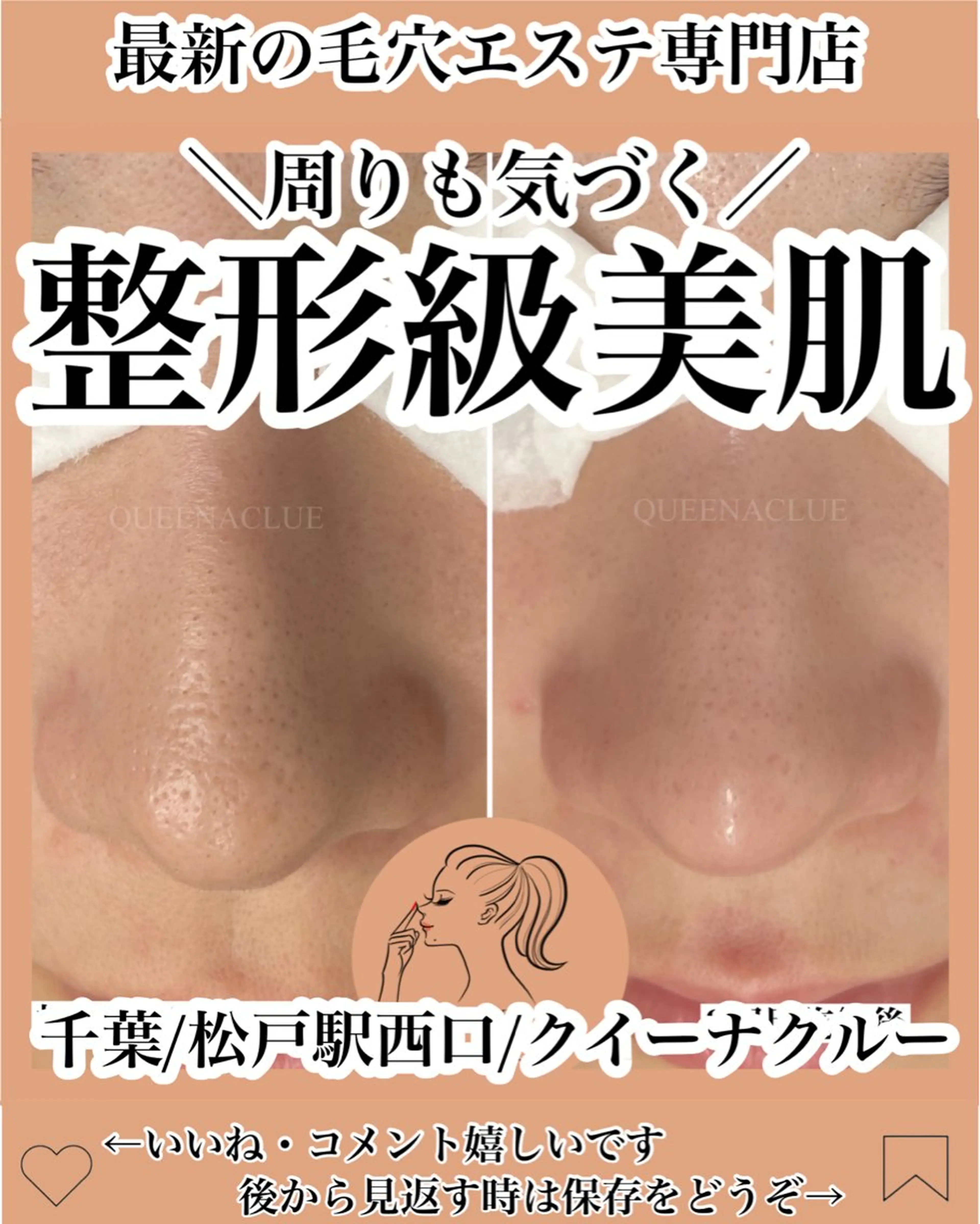 毛穴エクストラクションプロ/長年のいちご鼻から卒業/毛穴のザラつき/黒ずみ/毛穴の開きにも◎極上マッサージ付きの写真