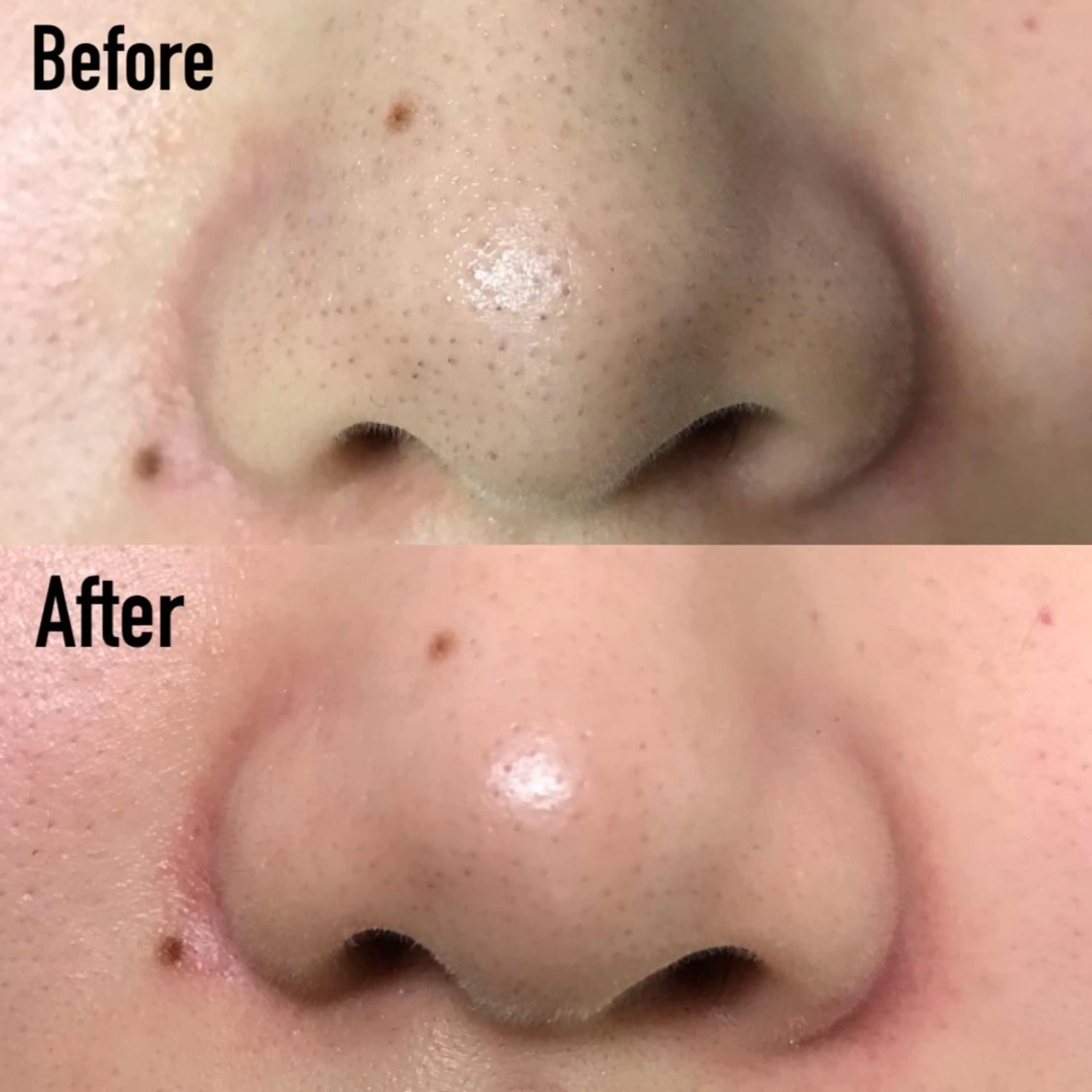 エステ 高速脱毛エステ リアンのエステ・リラクイメージ