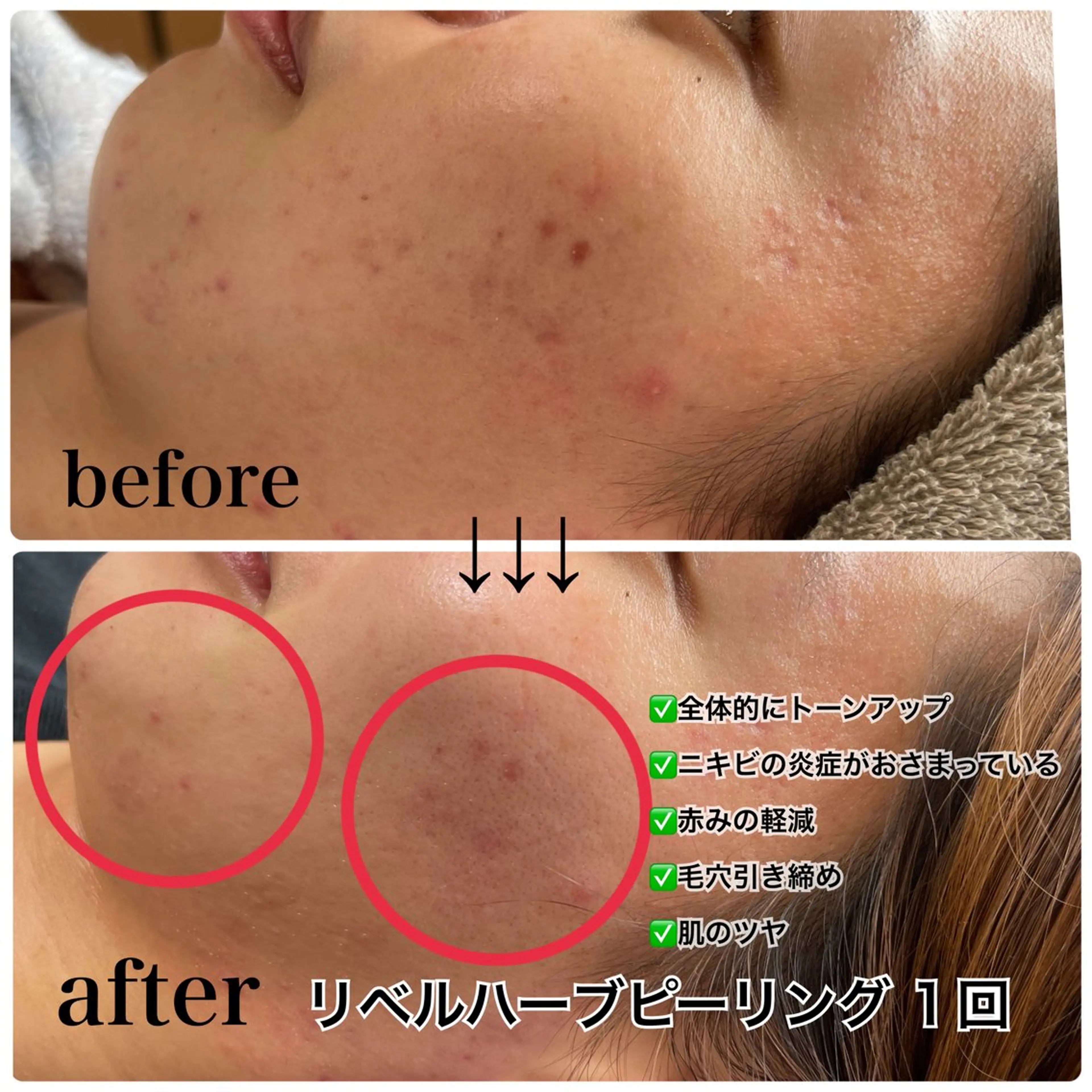 Liberte リベルテ(トモ化粧品店内)所属・Liberte’/ rinaのマツエク・マツパデザイン