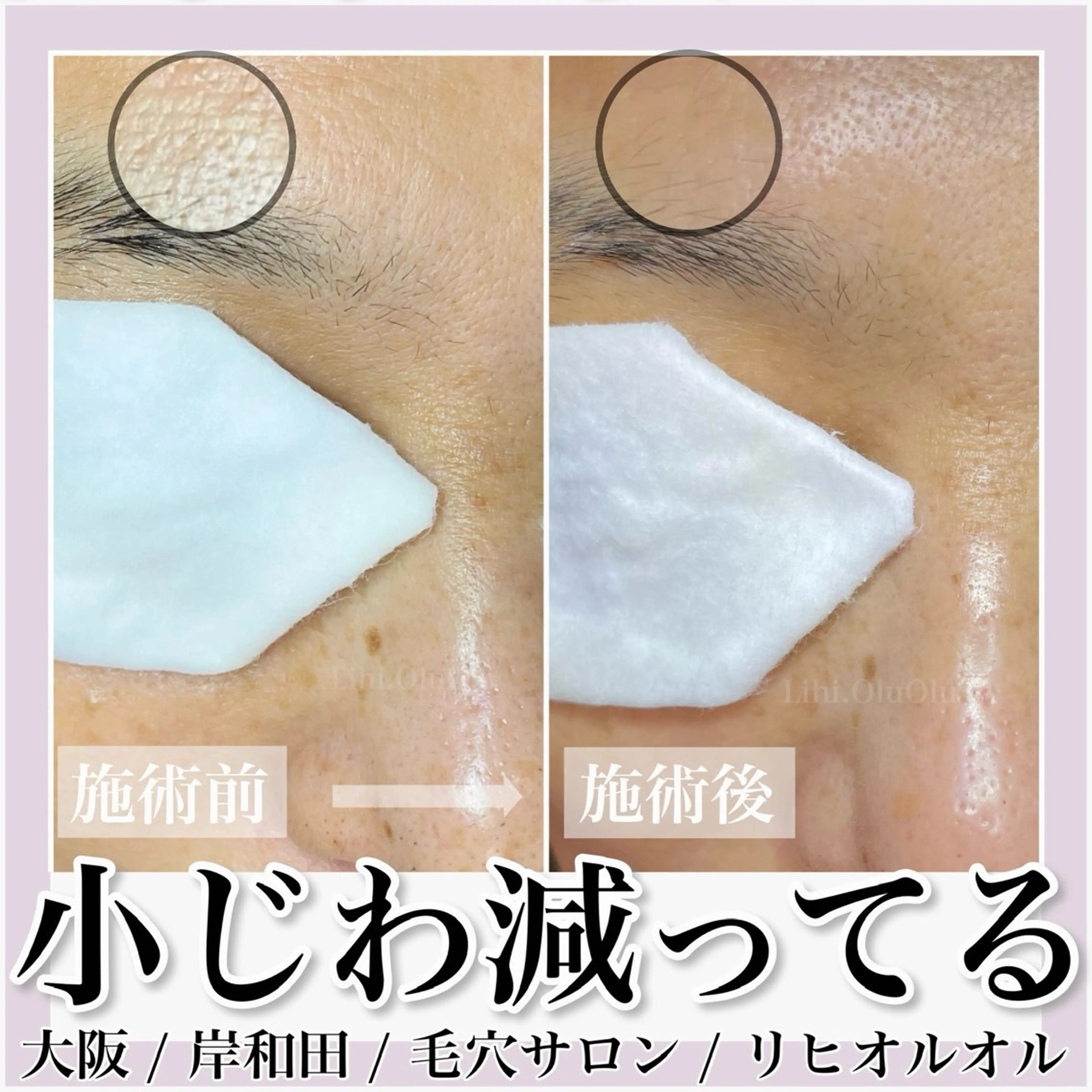 毛穴汚れ改善専門店/ 岸和田/リヒオルオルのエステ・リラクイメージ