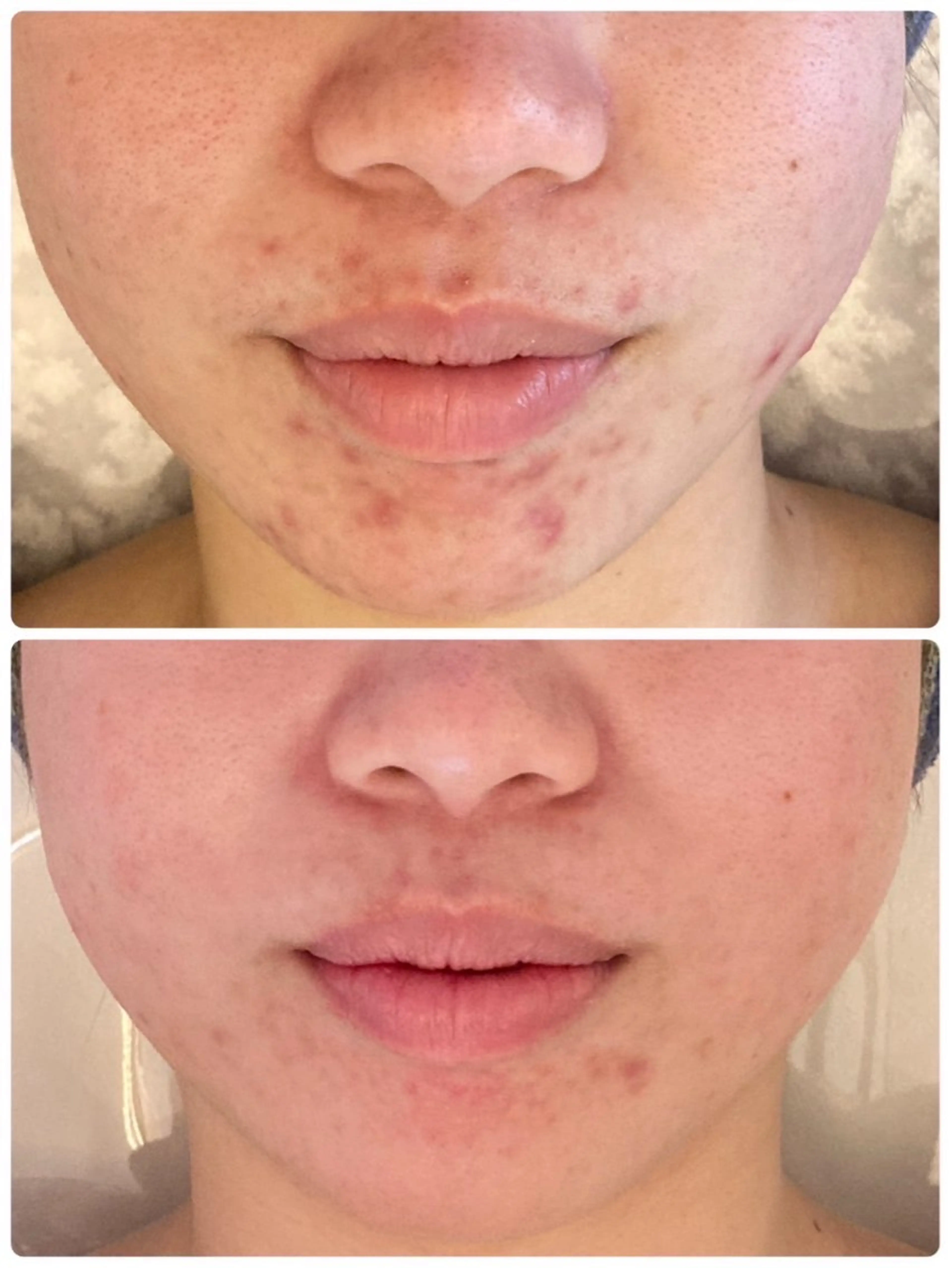 肌質改善サロン Manaririoのエステ・リラクイメージ