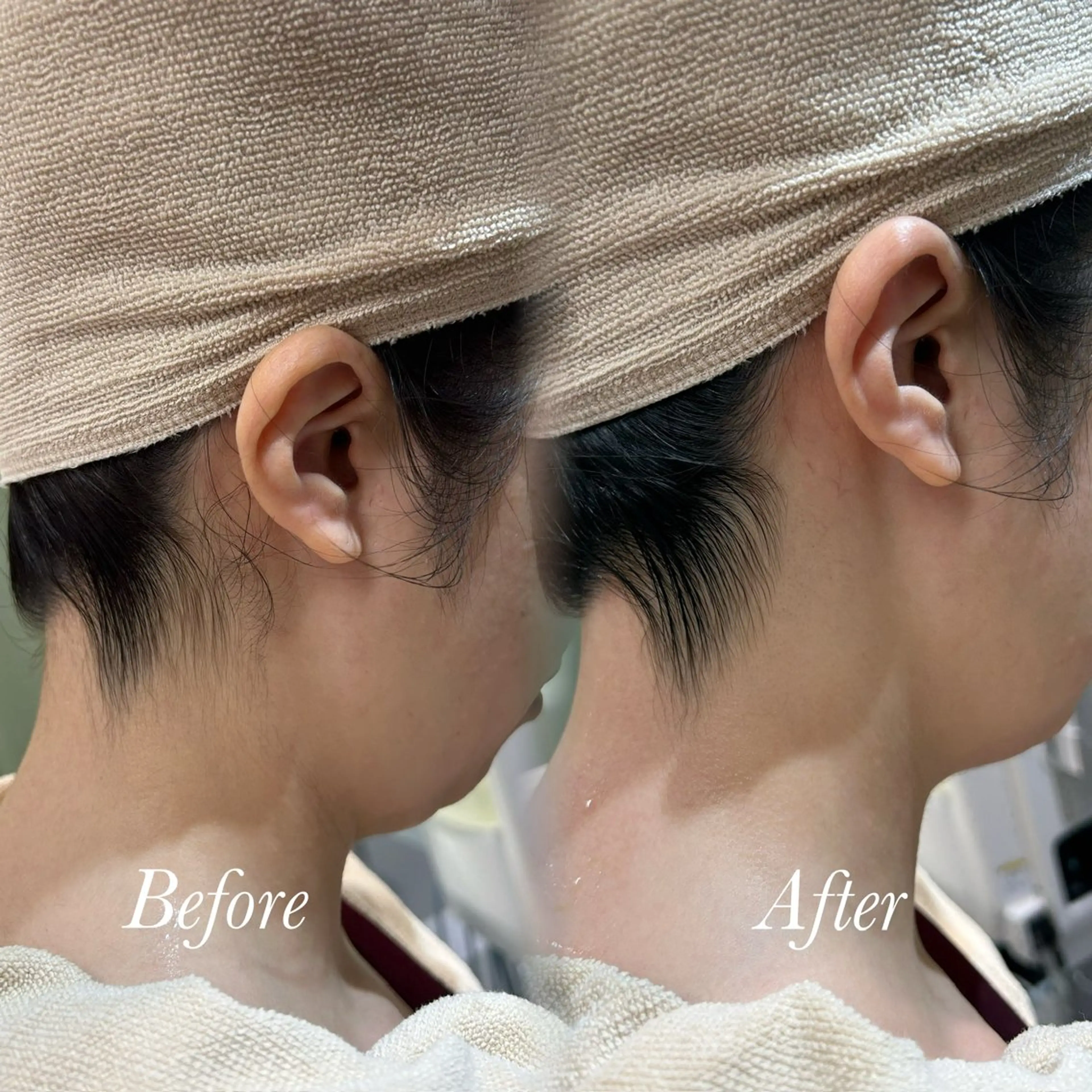 その他 🫧美しい素肌へ🫧 今成柚乃のその他イメージ