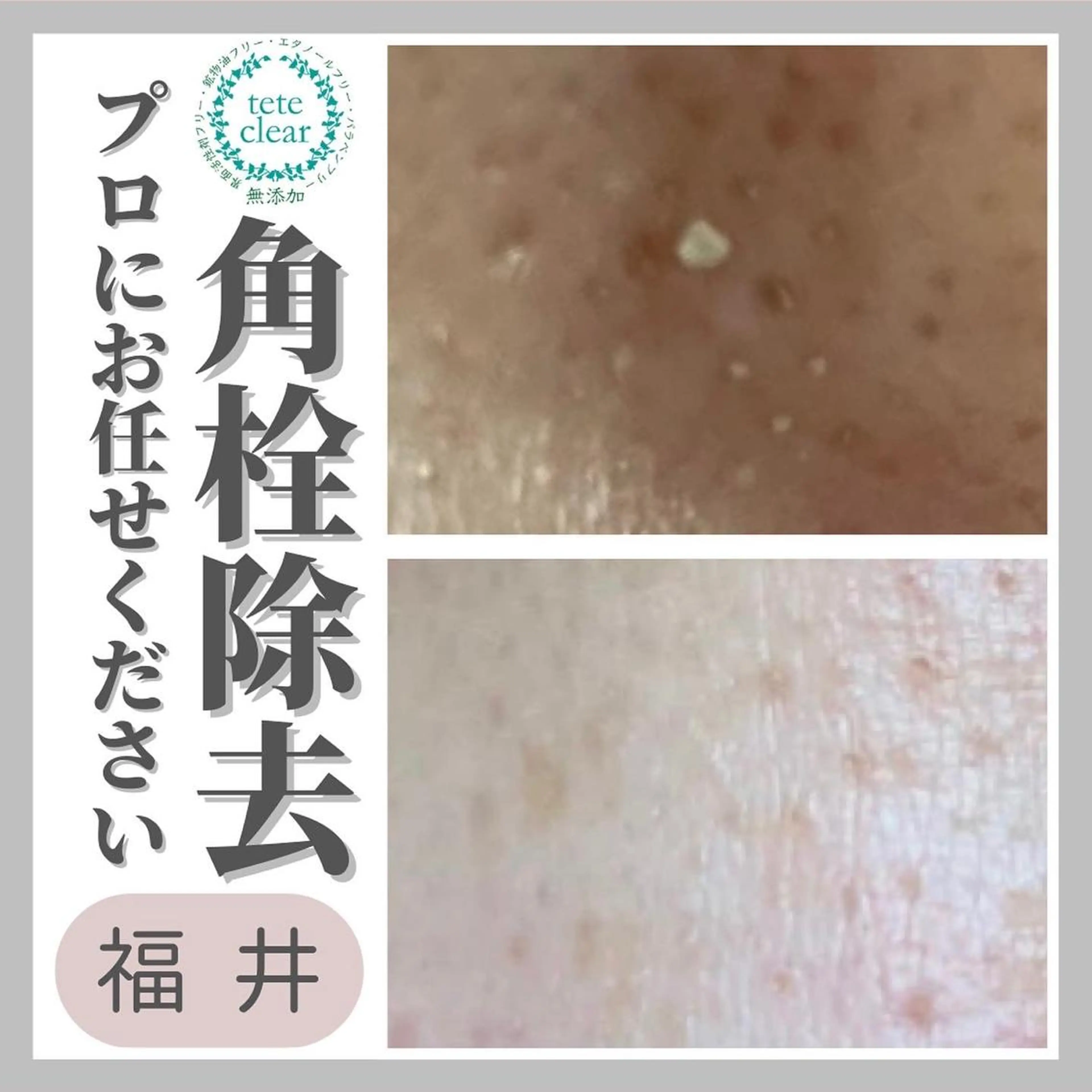 毛穴肌質ケアサロン Yourmeユアミーのエステ・リラクイメージ