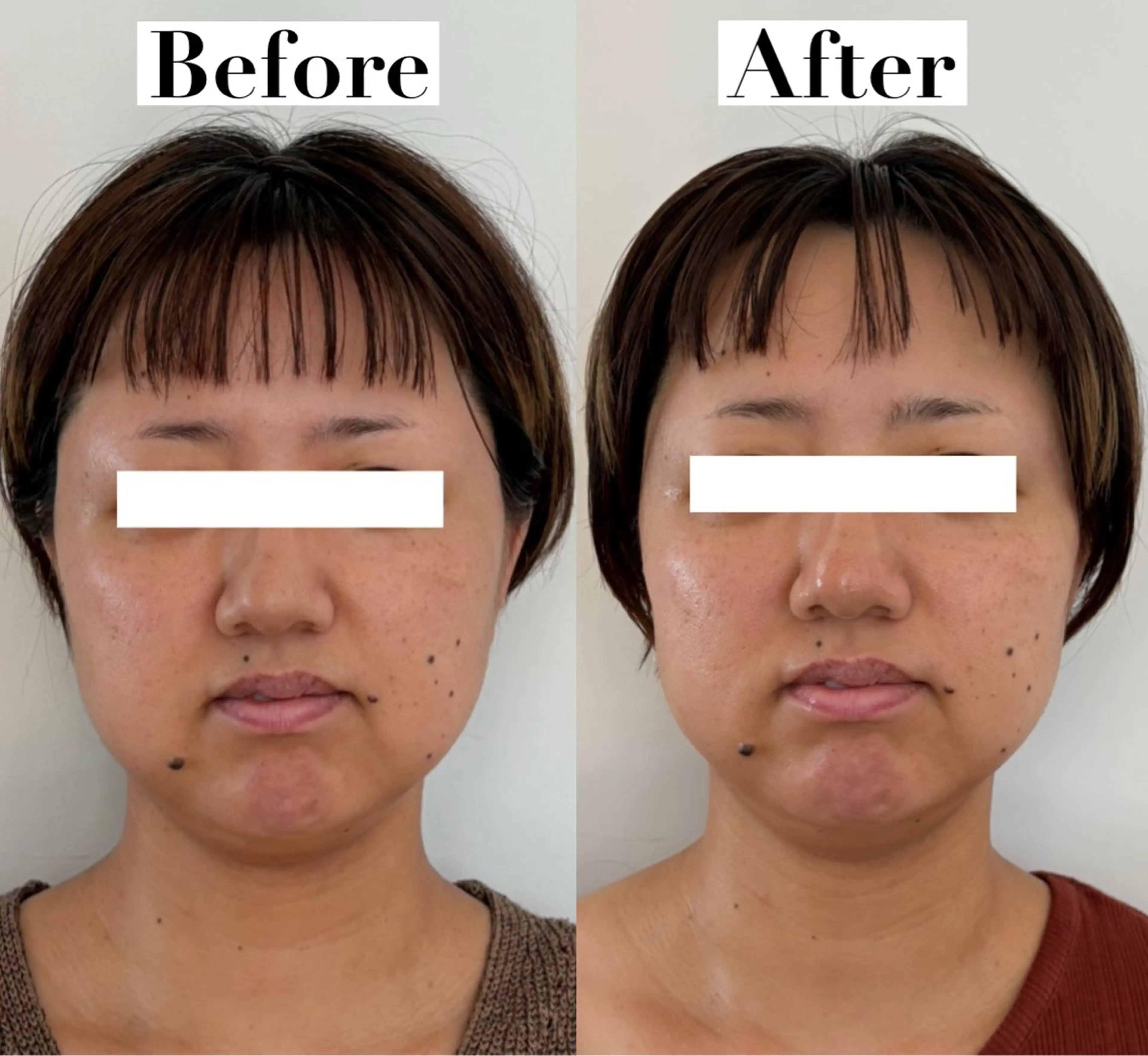 エステ リラク たるみ改善サロン Ｍdesignのエステ・リラクイメージ