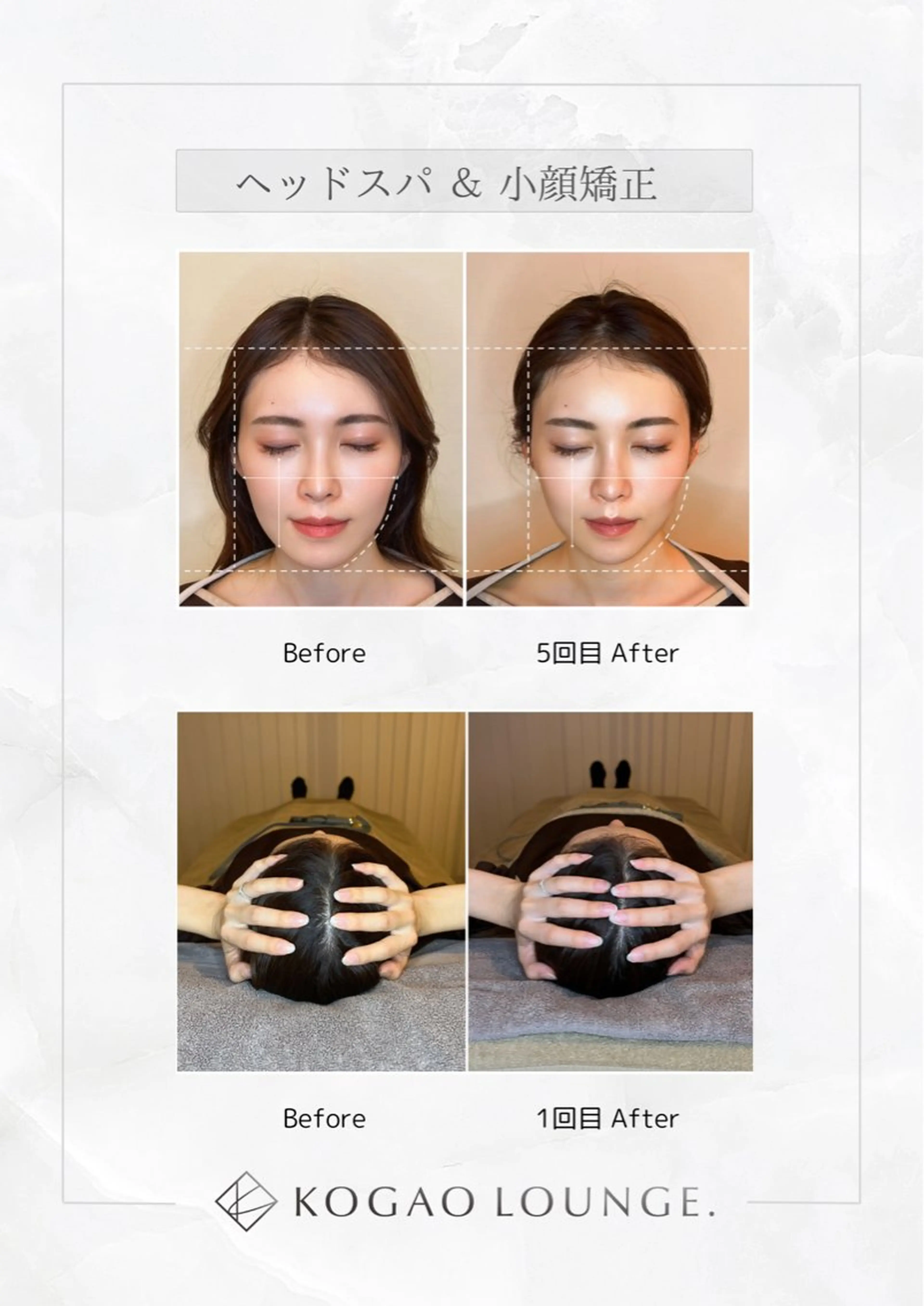 【人気NO.1✨】小顔に特化したヘッドスパ+小顔ケア¥14,000→¥3,000の写真