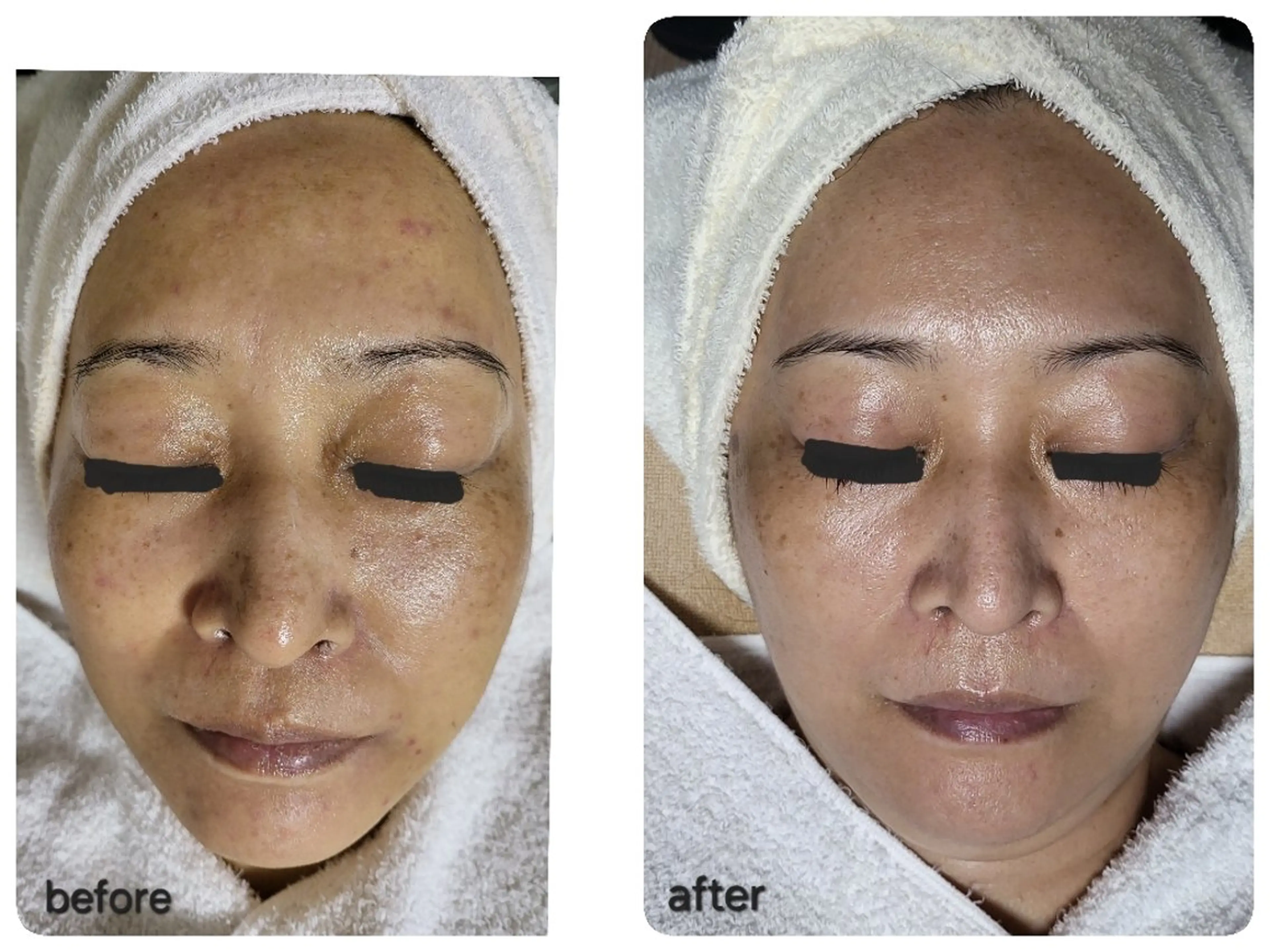 エステ ニキビ・ニキビ跡専門 レゾン京橋店　のエステ・リラクイメージ