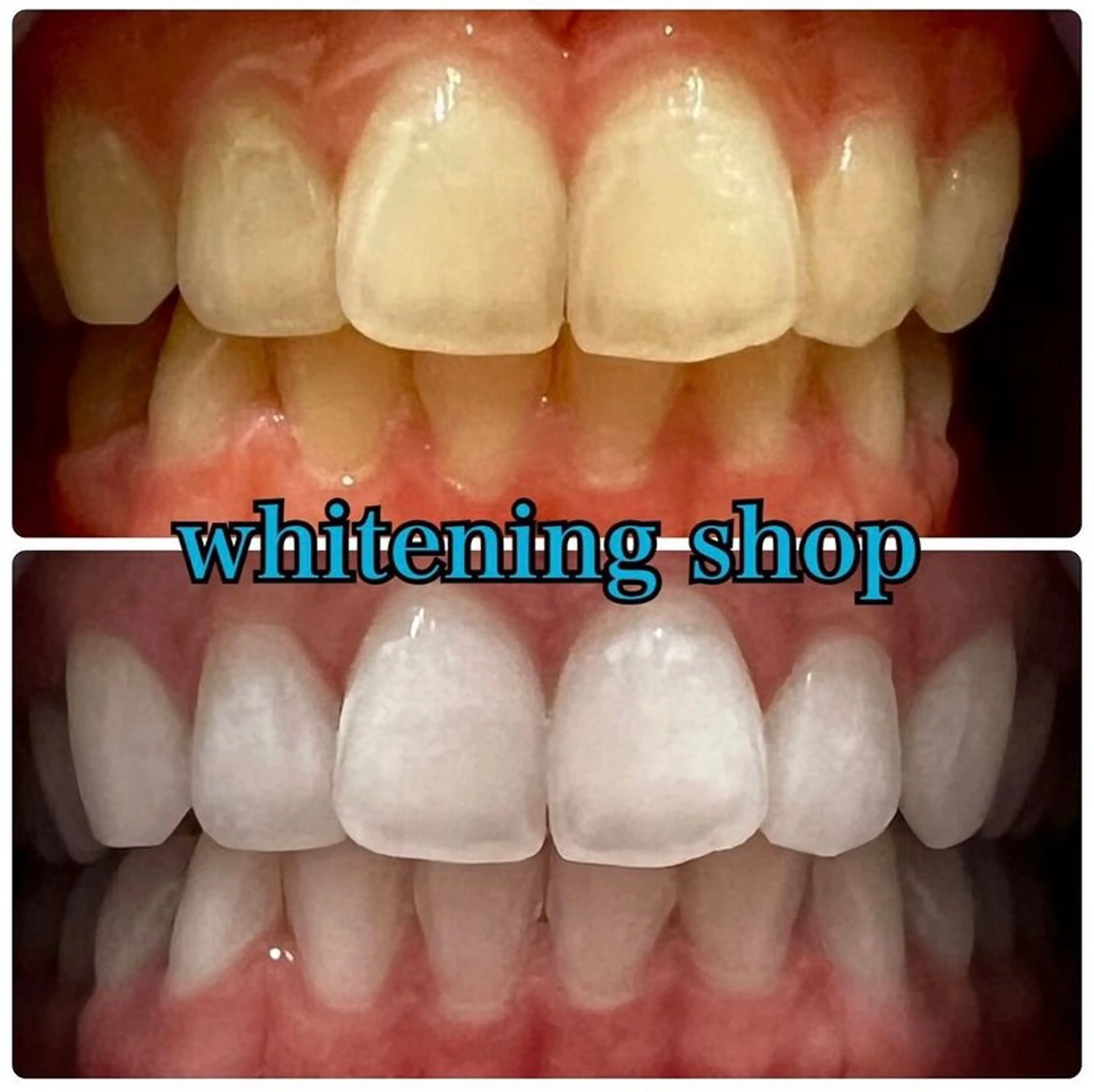 エステ リラク ホワイトニング ショップ吉祥寺店のエステ・リラクイメージ