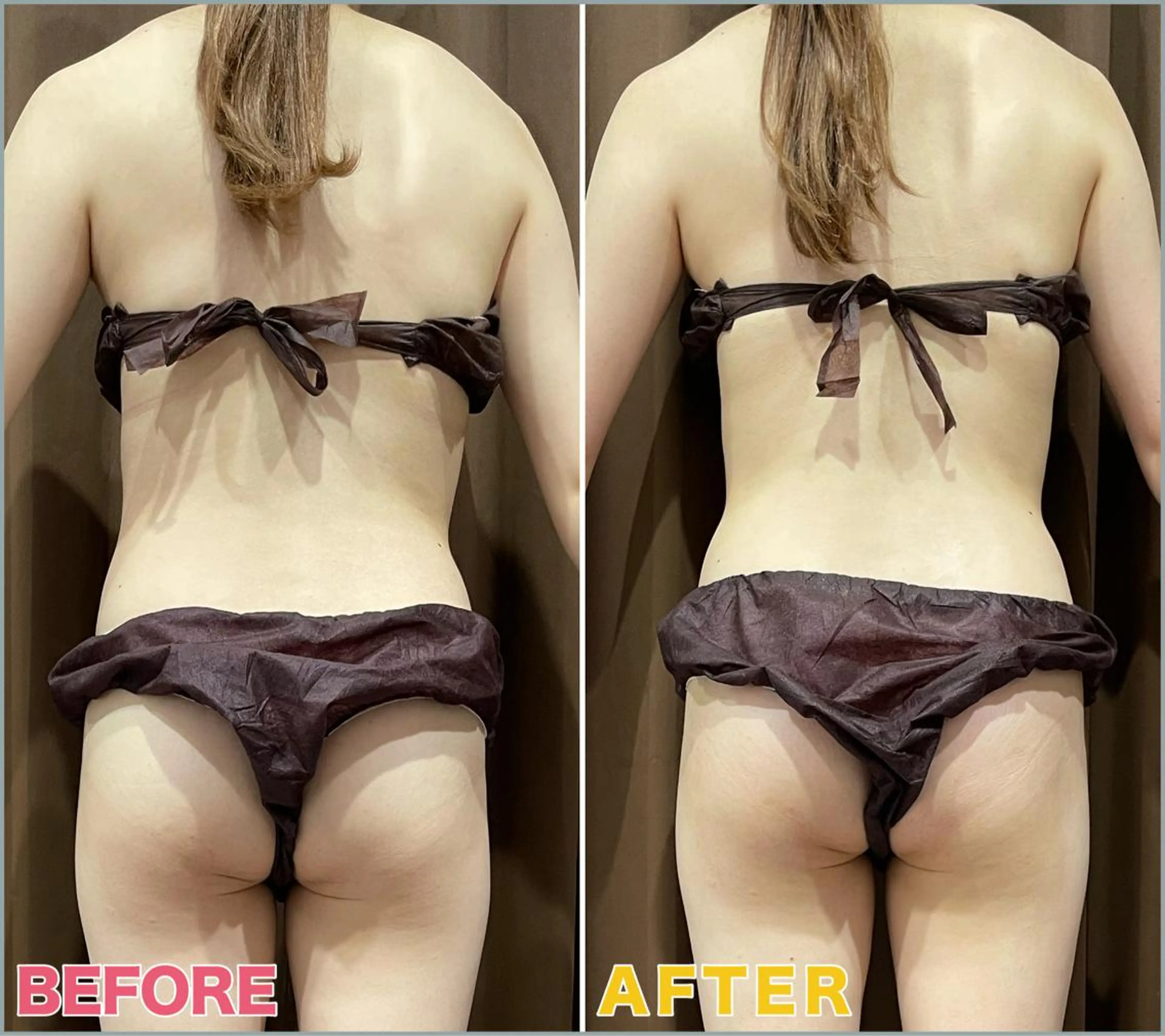 エステ VIVACE YUMEのその他イメージ