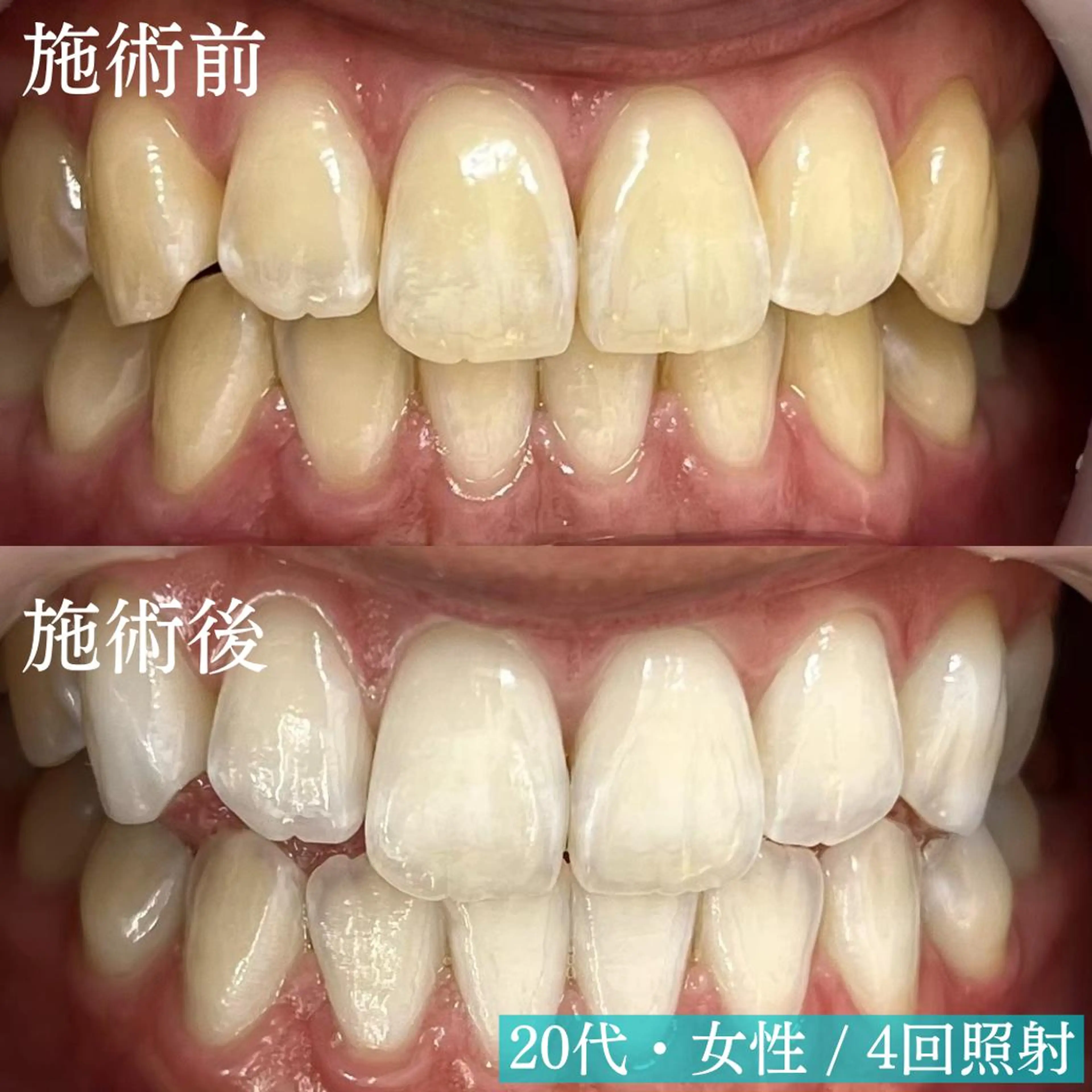 LBSホワイトニング 新宿店💎公式のその他イメージ