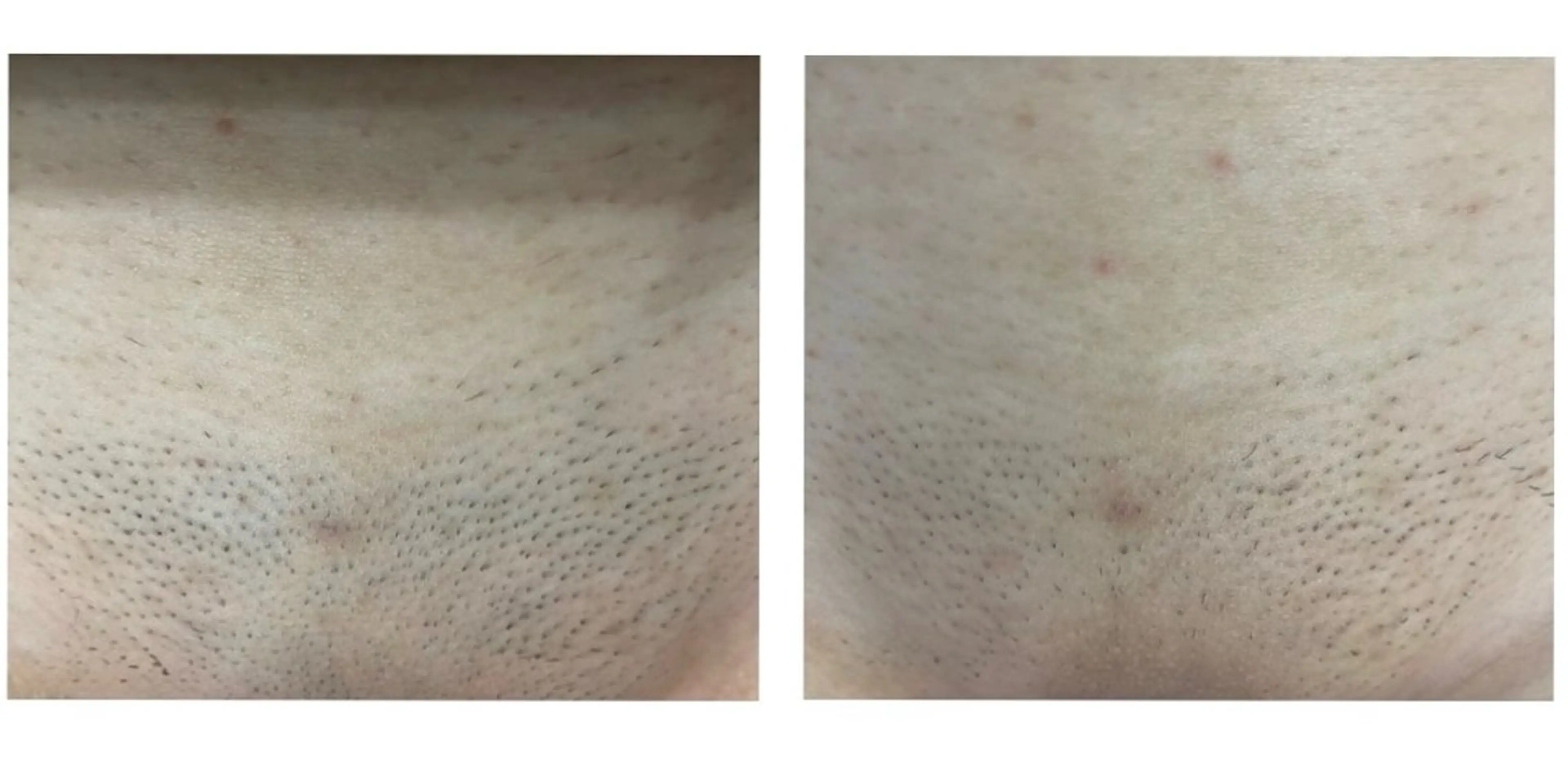 RIKKA☆脱毛/ アイブロウ/メイクの眉毛・アイブロウイメージ