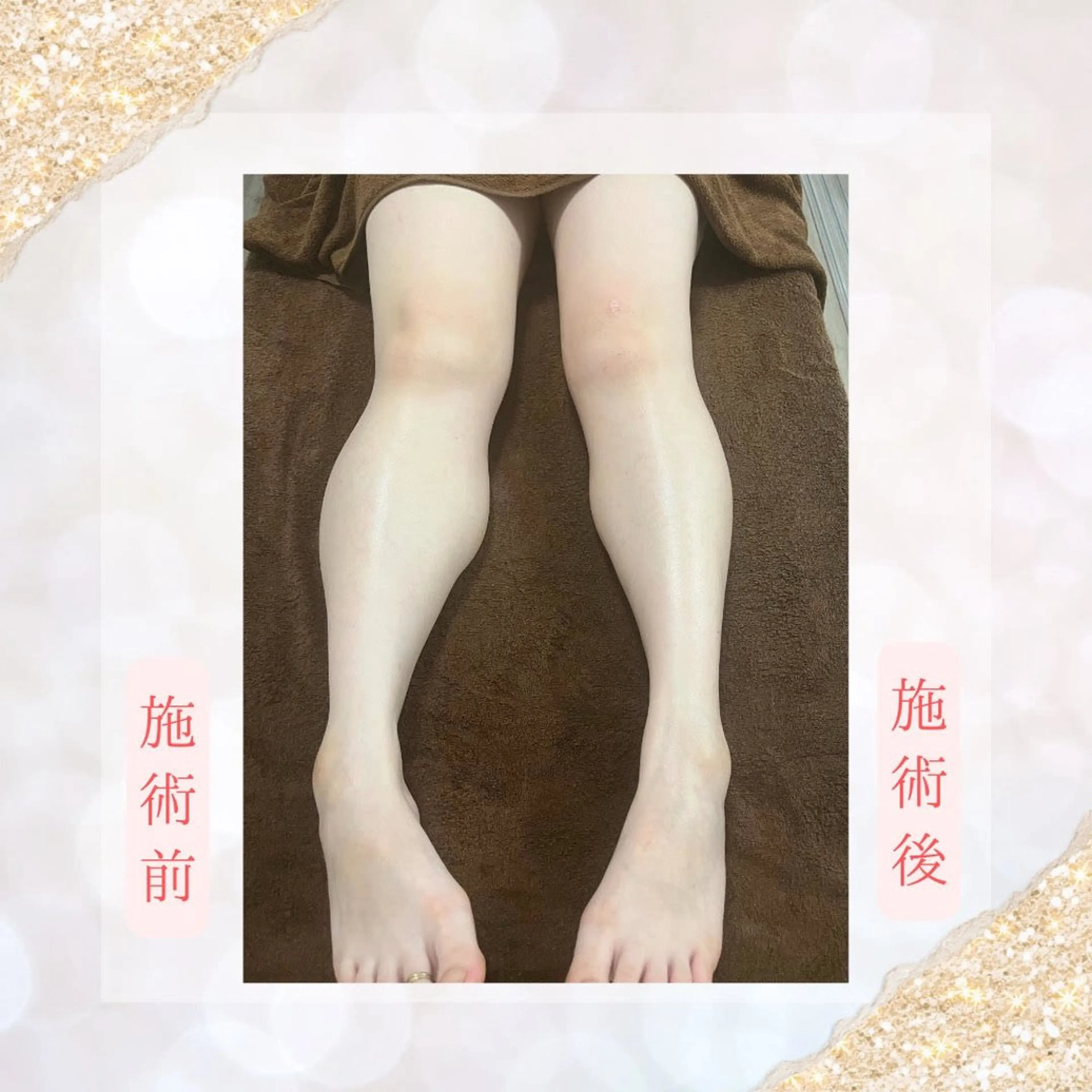 cocorela 森脇奈美のエステ・リラクイメージ