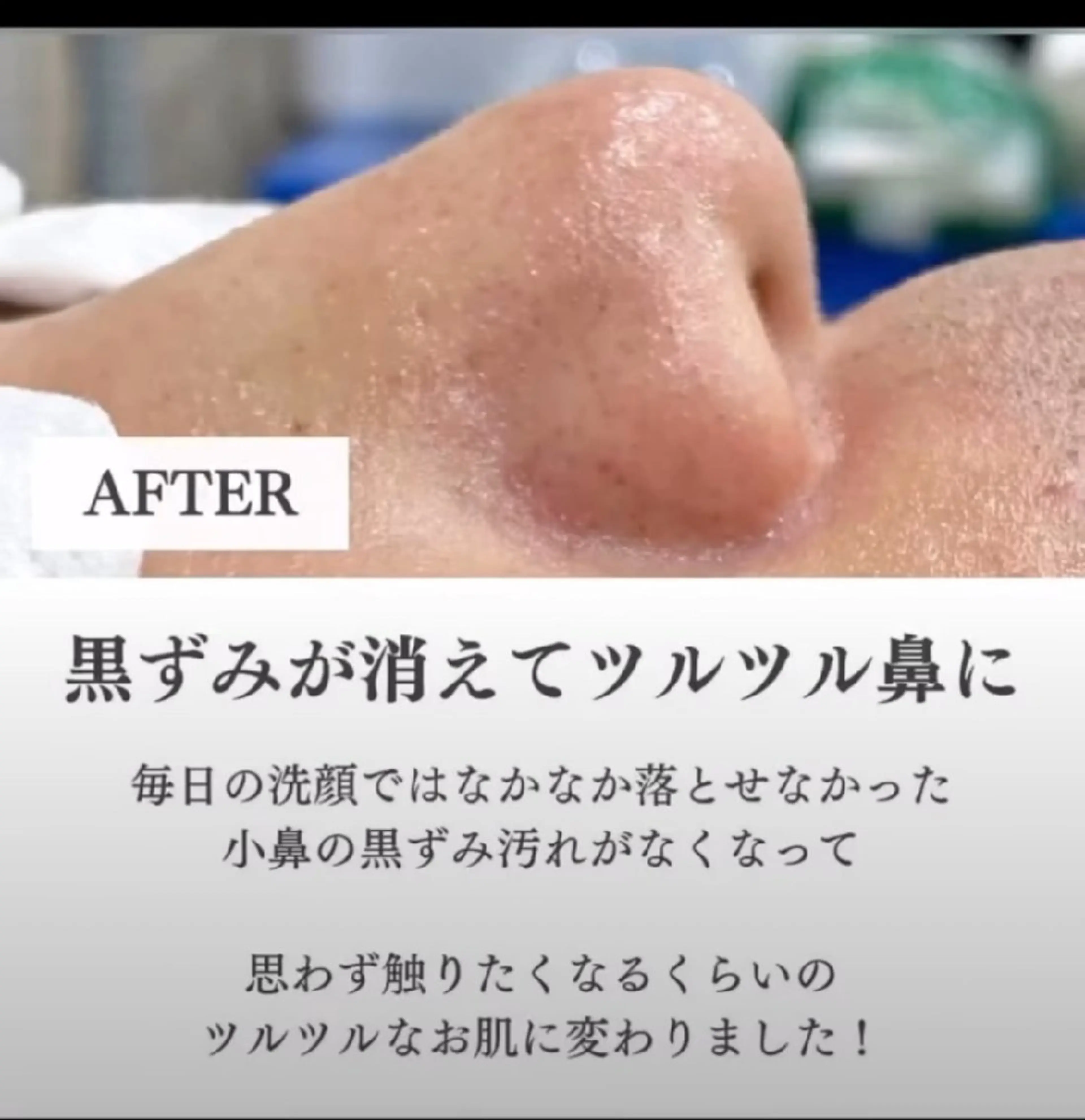 肌質改善BIOELプ ラズマ/ラミピールのエステ・リラクイメージ