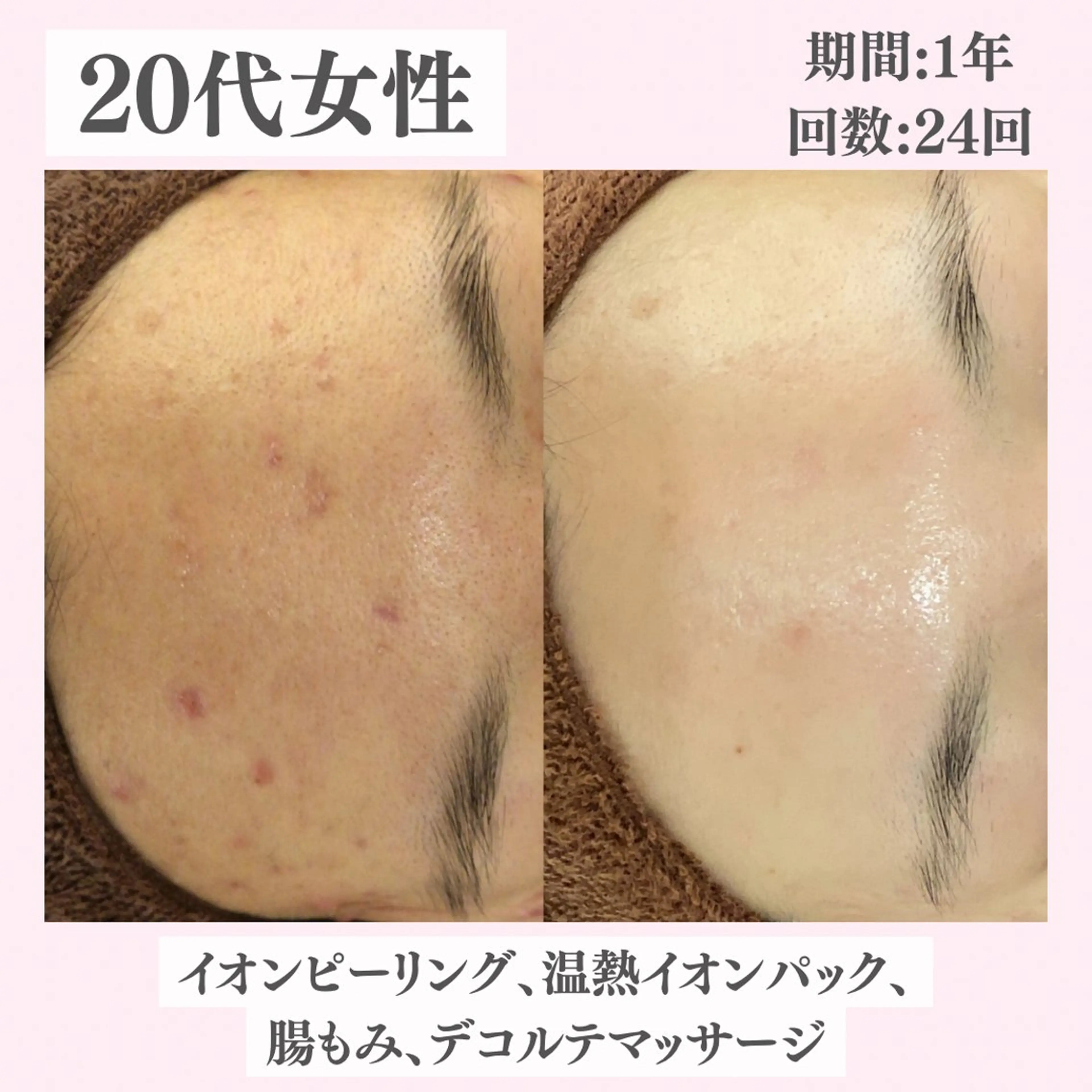 エステ リラク ニキビ・肌質改善専門 ♡人生が変わるサロンのエステ・リラクイメージ