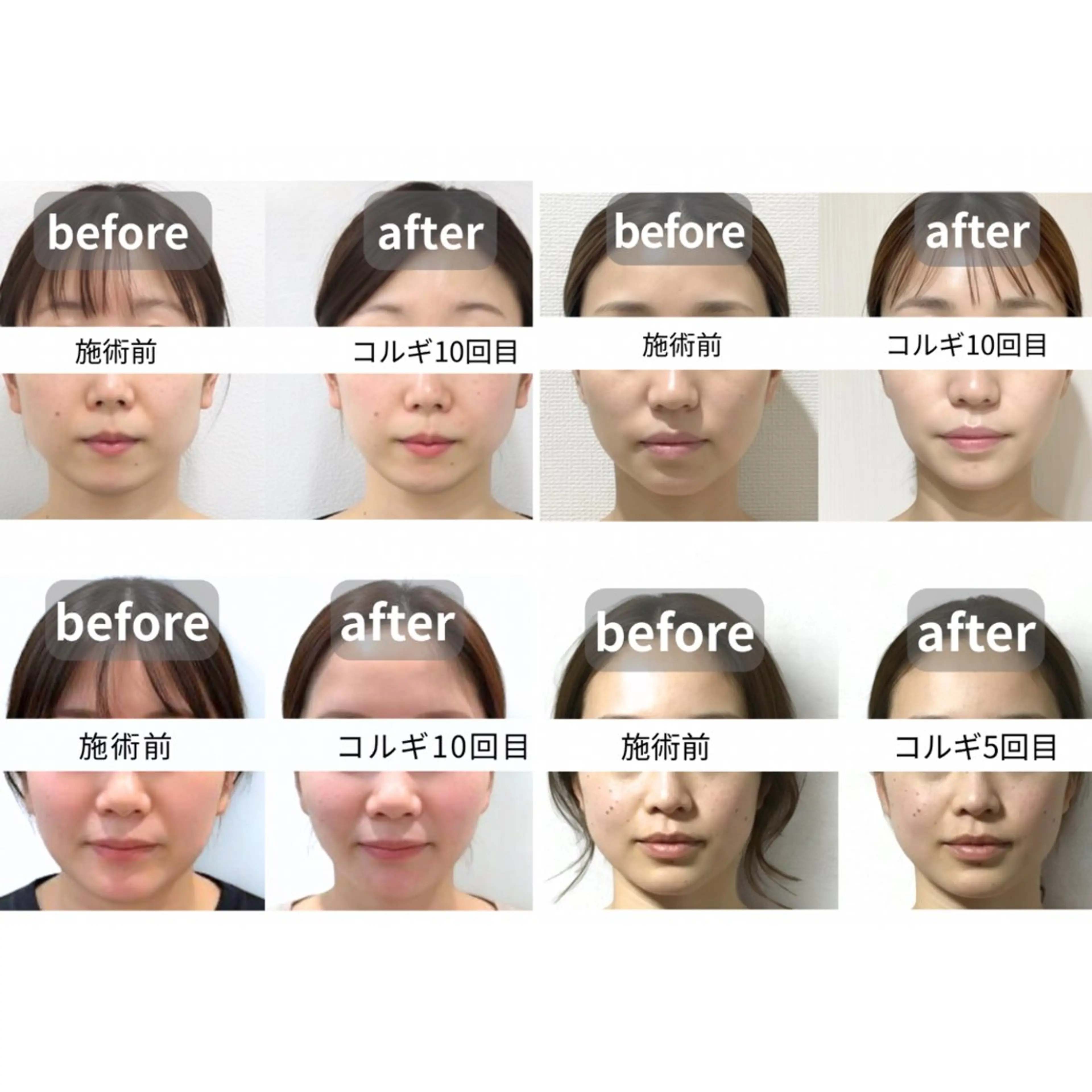 小顔コルギSalon de ETULEのエステ・リラクイメージ