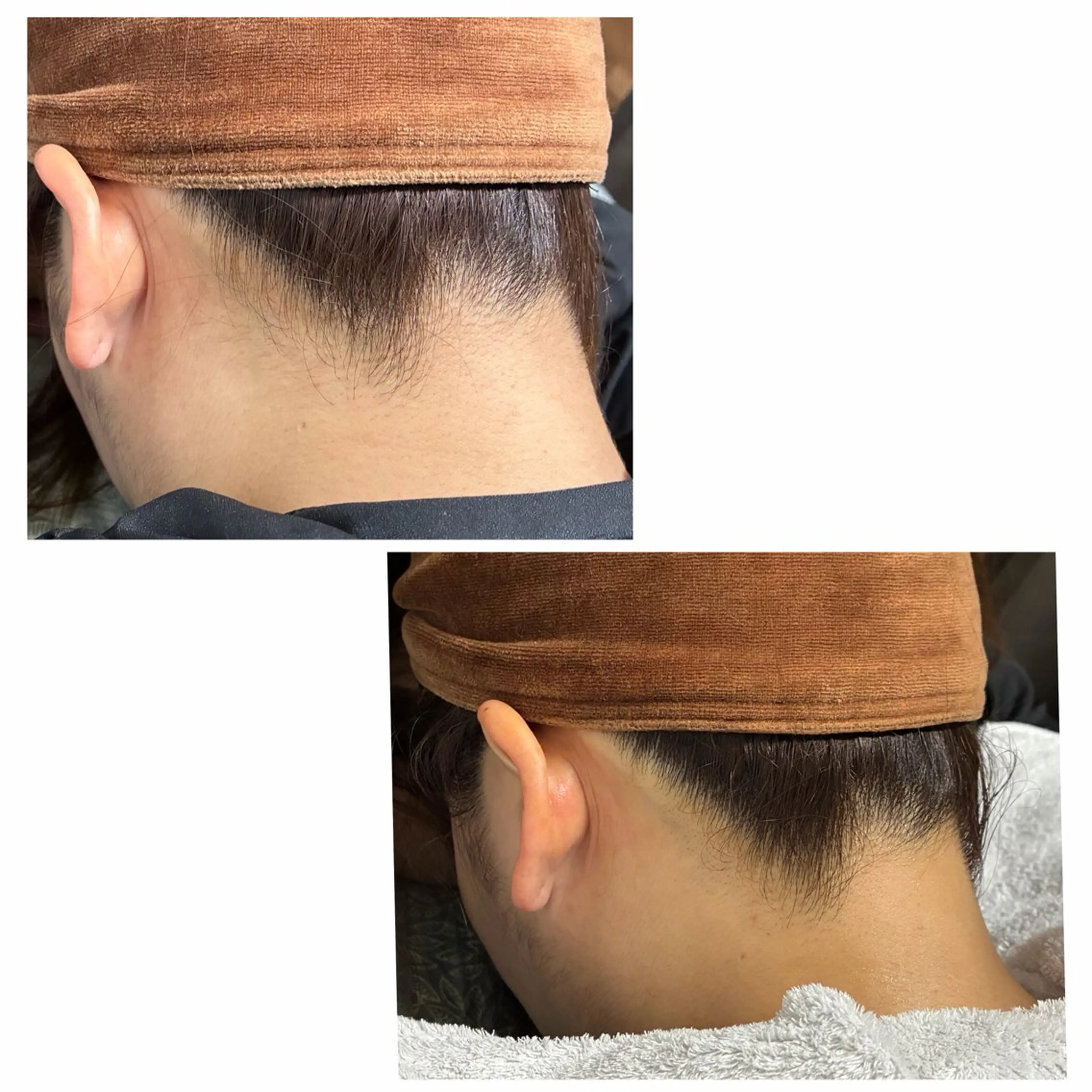 DISINISPA 脱毛/フェイシャルのエステ・リラクイメージ